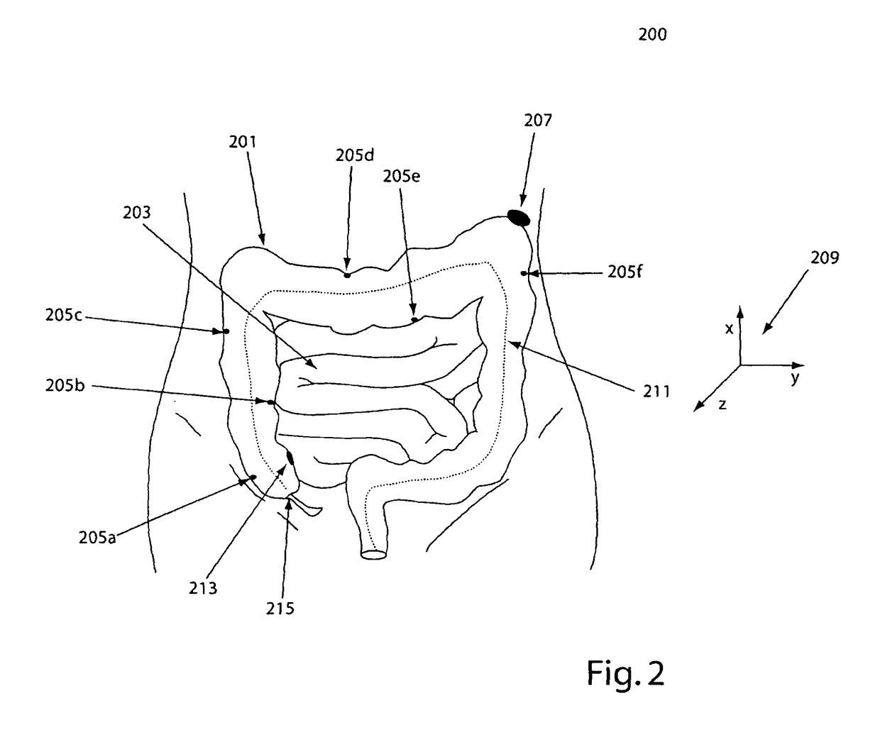 System, method and devices for navigated flexible endoscopy