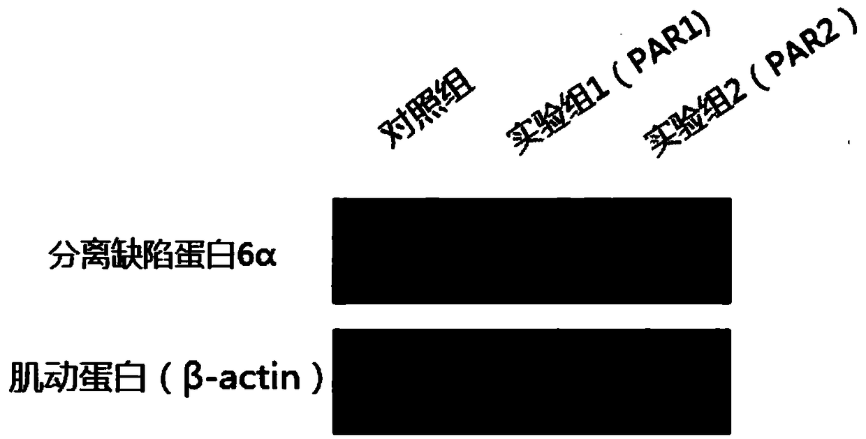 Small interfering ribonucleic acid sequence for inhibiting expression of human pard6a gene and its application in resisting proliferation and metastasis of ovarian cancer