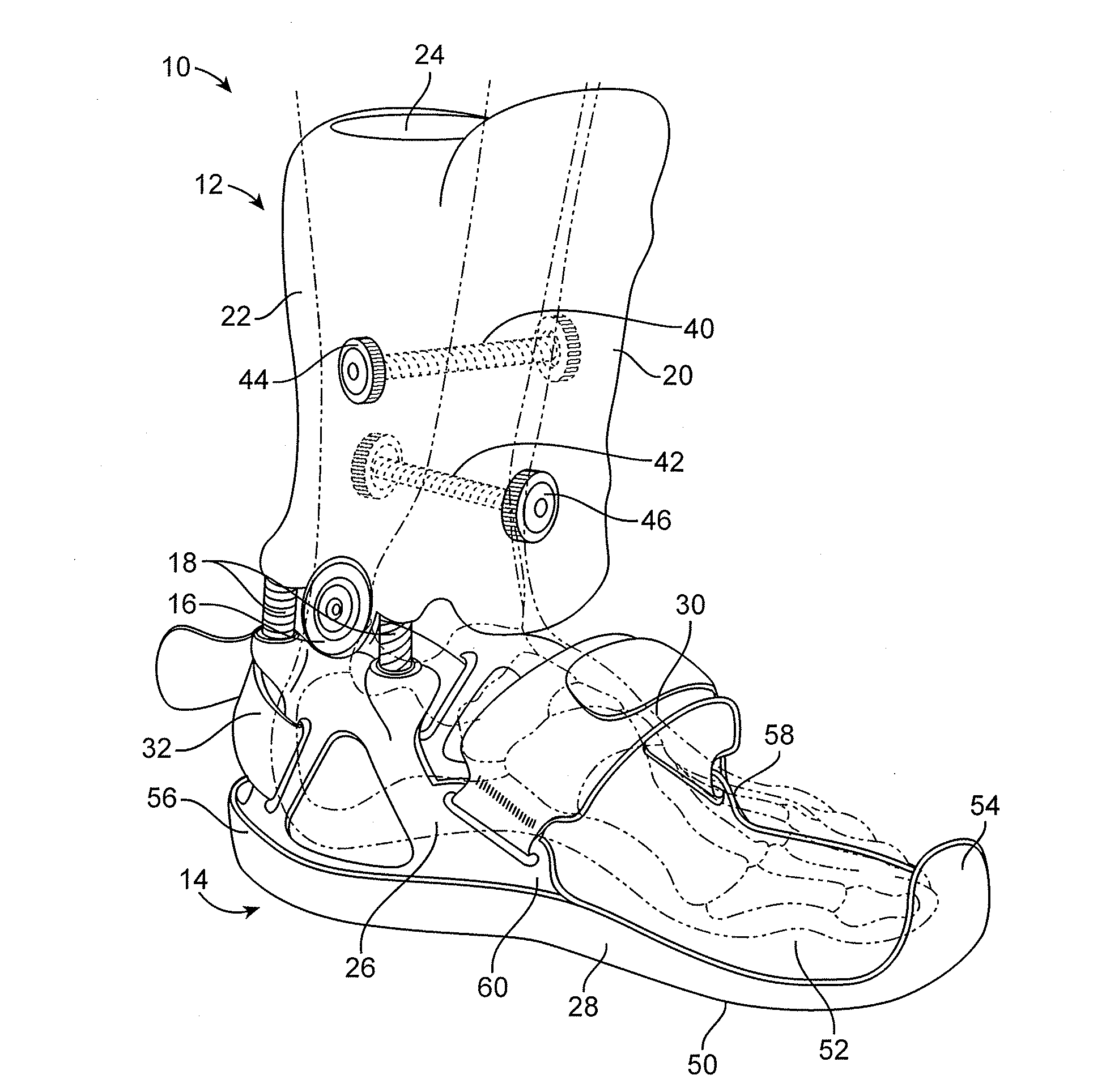 External ankle distraction and load bypassing system and method