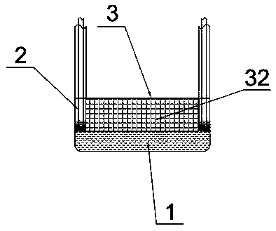 Ultrasound probe cover of laparoscope