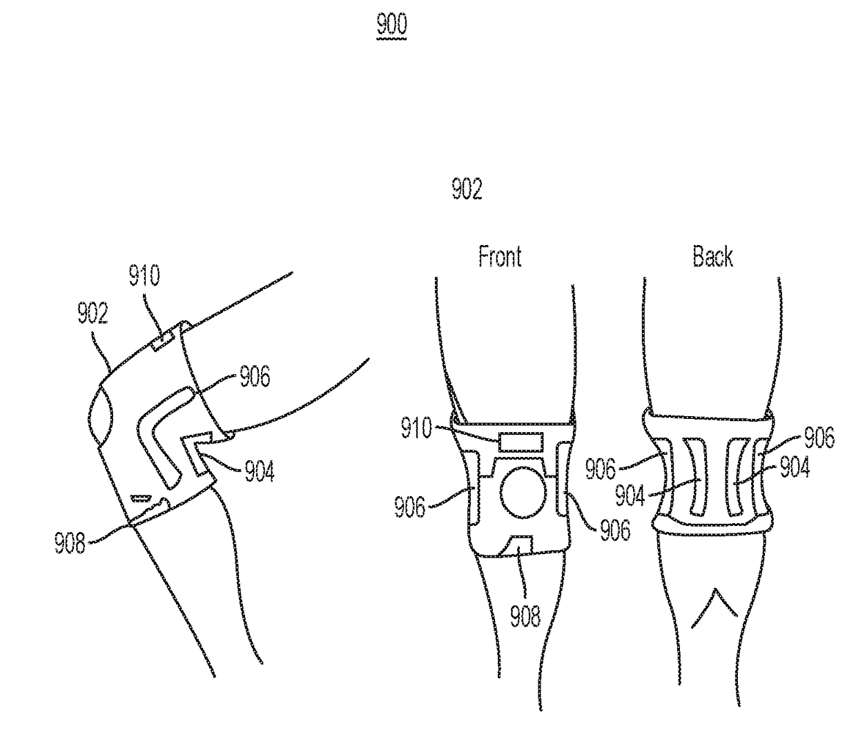 System and method for a wearable knee injury prevention