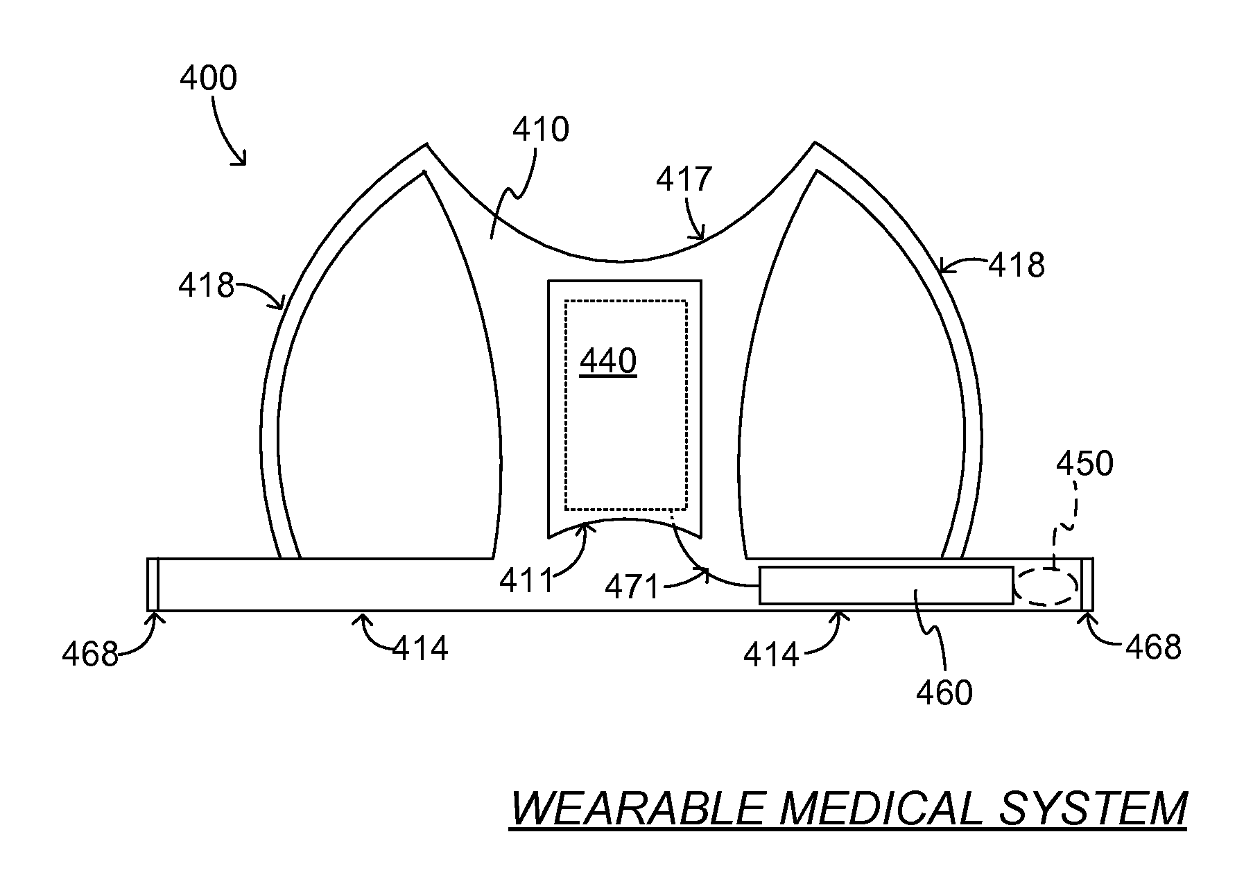 Wearable medical system with stretch-cable assembly