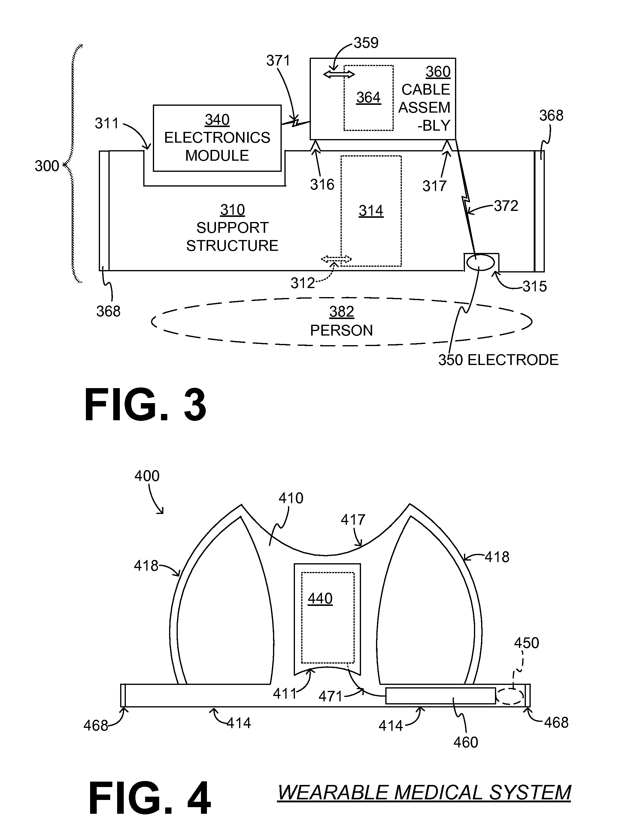 Wearable medical system with stretch-cable assembly