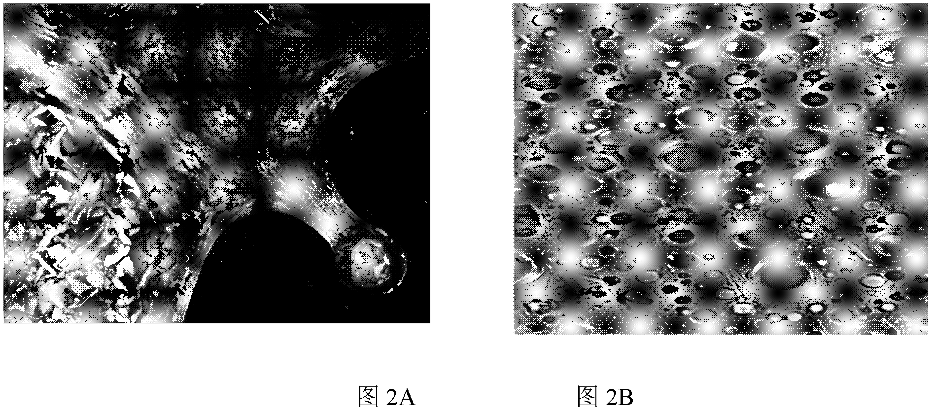 Cubic water quality liquid crystal gel transdermic absorption preparation containing oxybutynin chloride and preparing method thereof