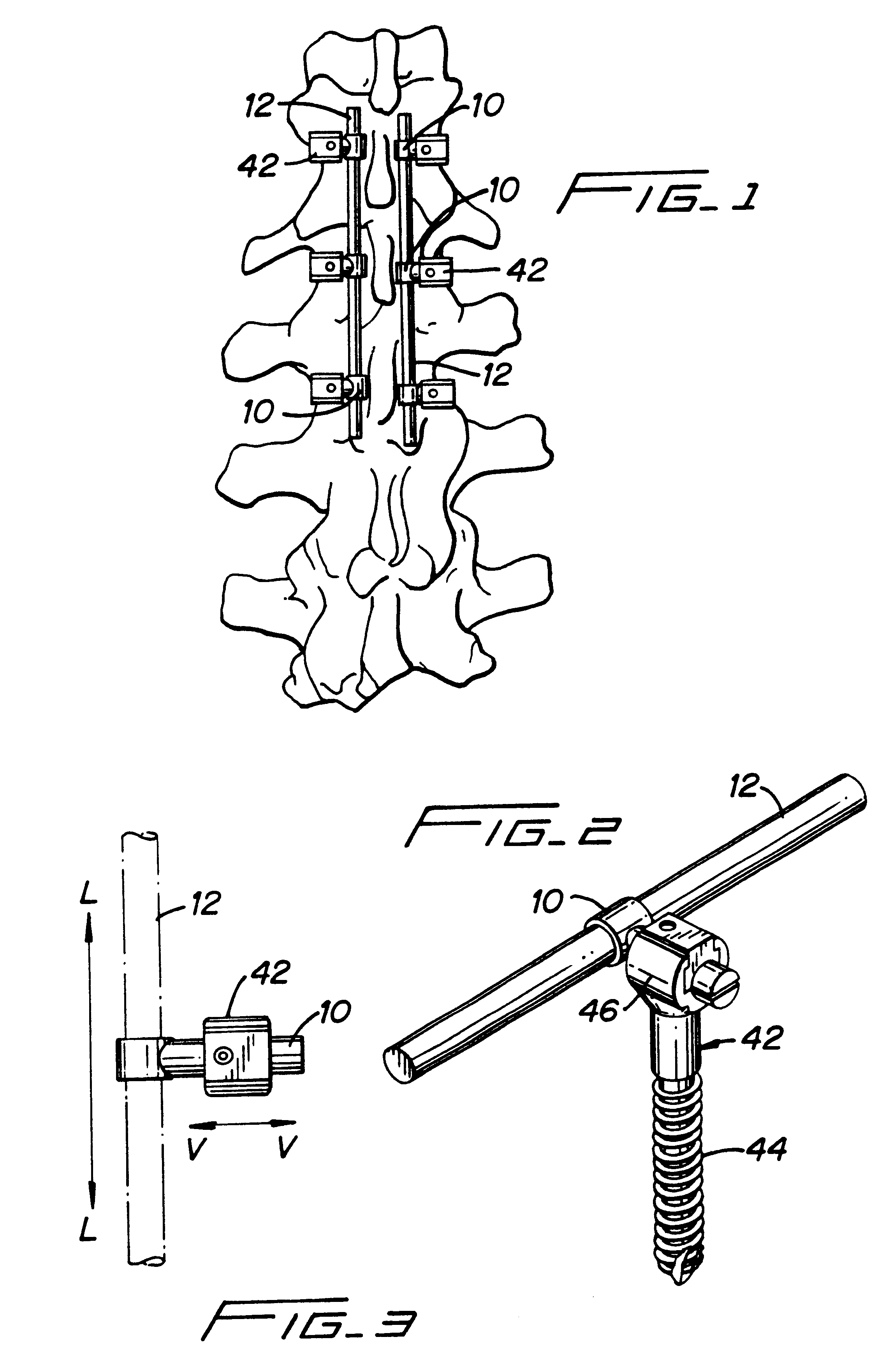 Clamping connector for spinal fixation systems