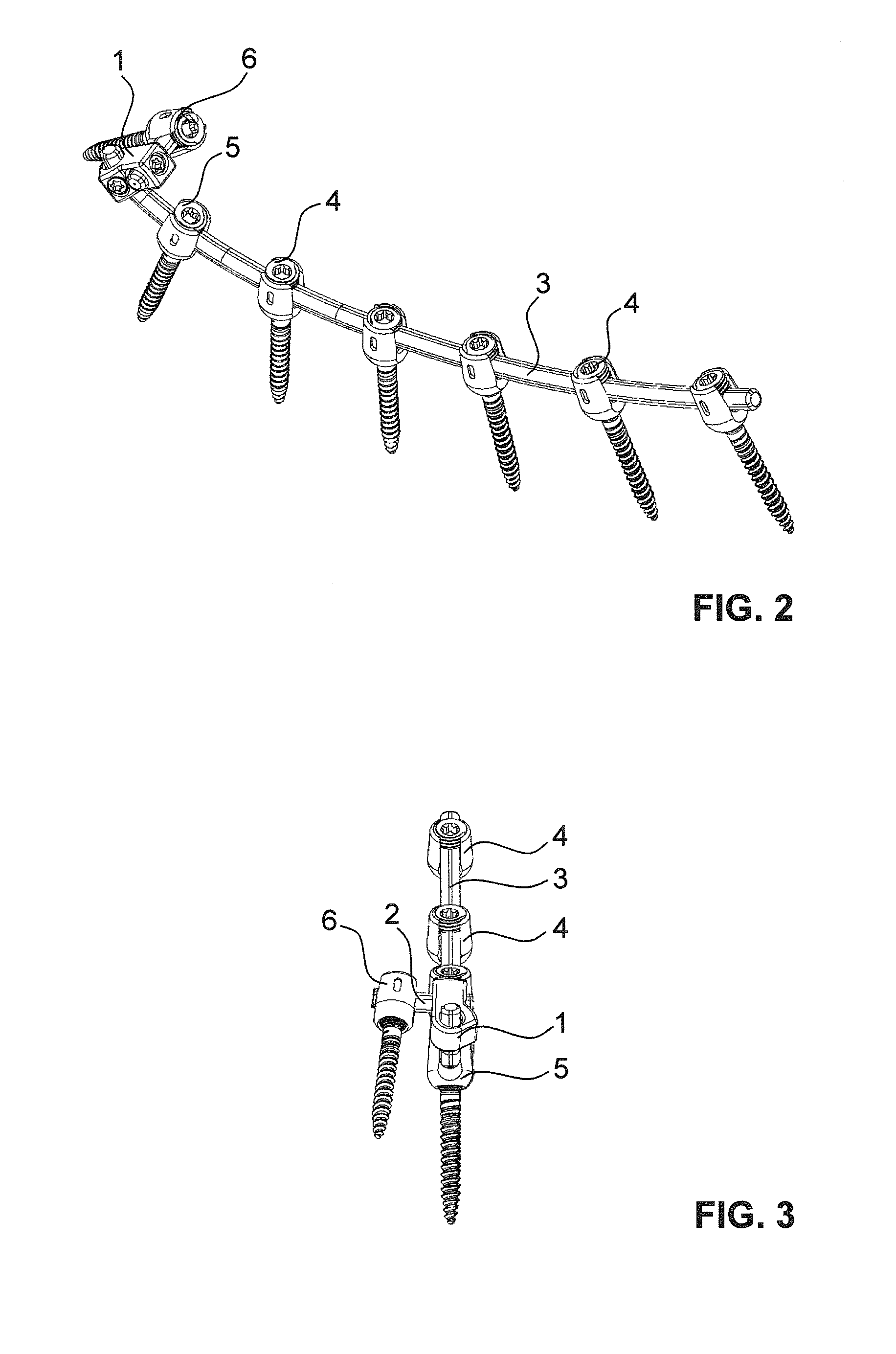 Iliac connector, connector head, spinal fixation system and method of stabilizing a spine