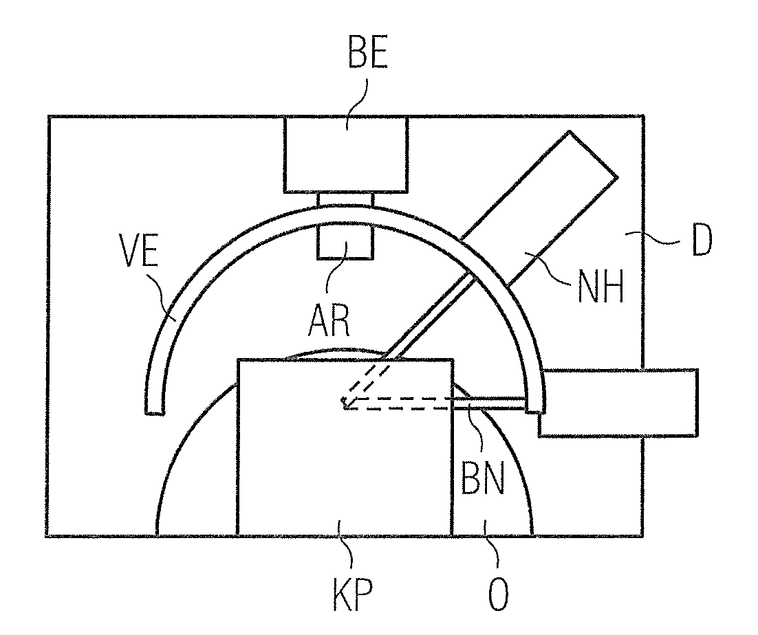 Device for tissue extraction