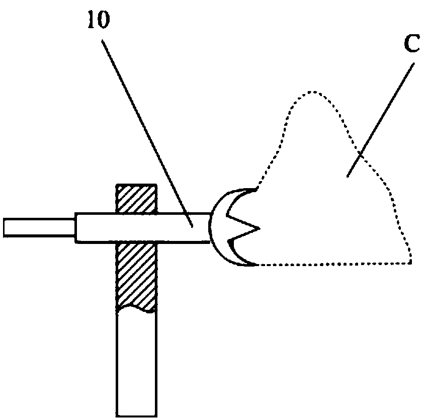 Distal Femoral Rotation Positioner