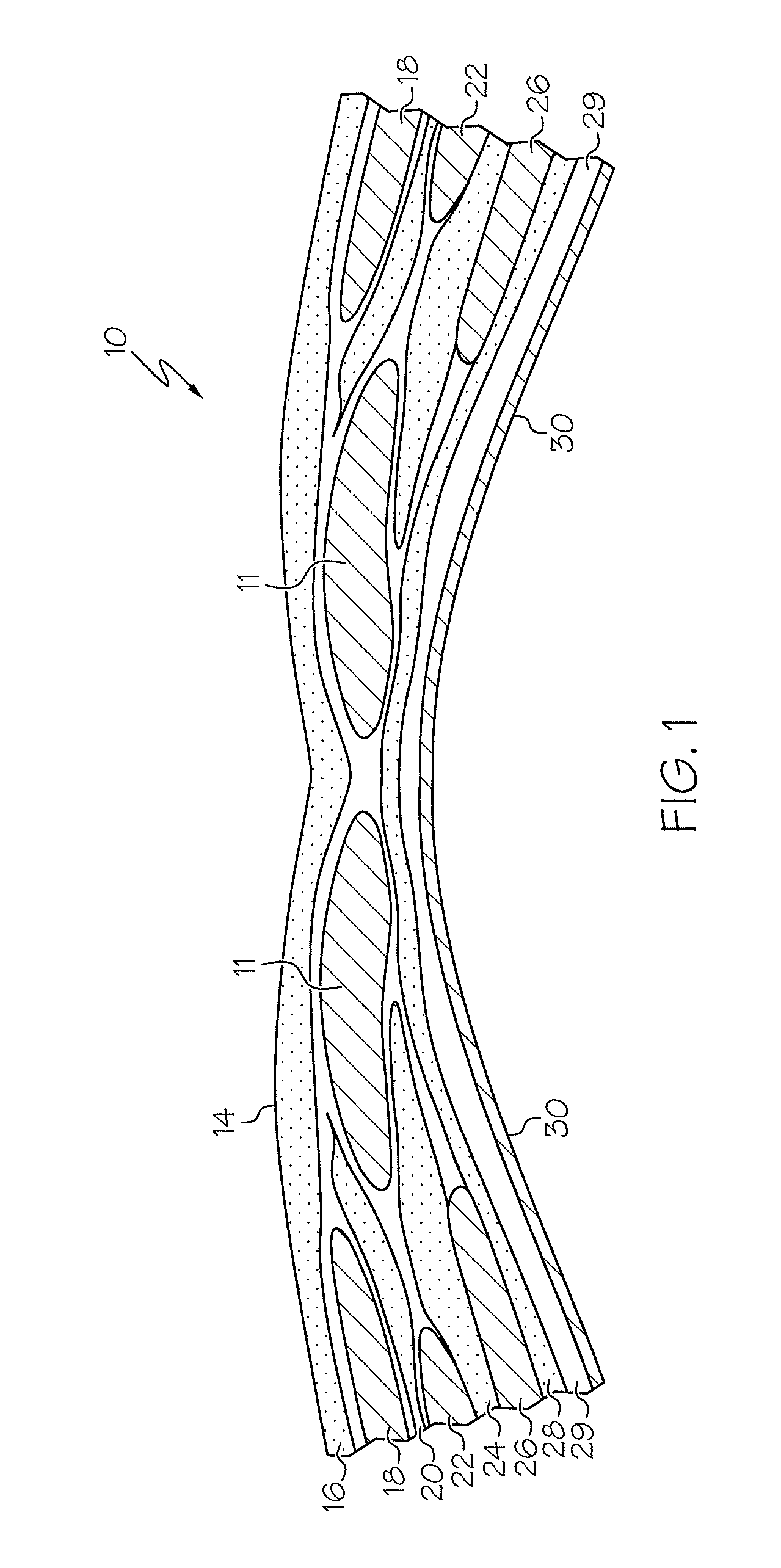 Laparoscopic wound closure device