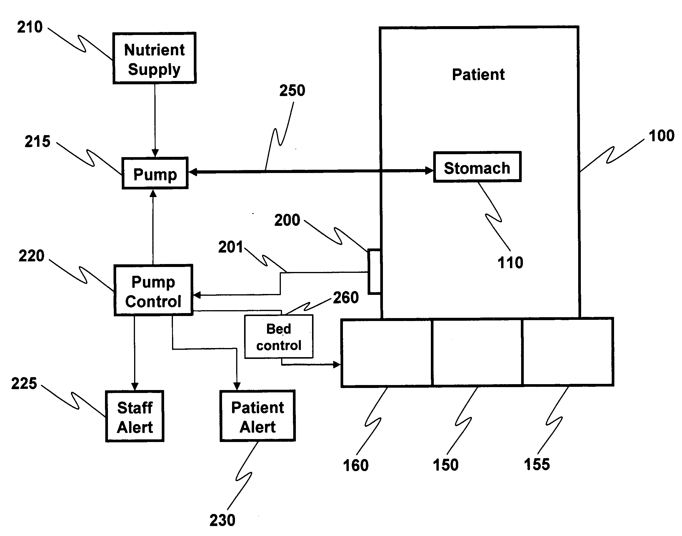 Retrofittable aspiration prevention mechanism for patients