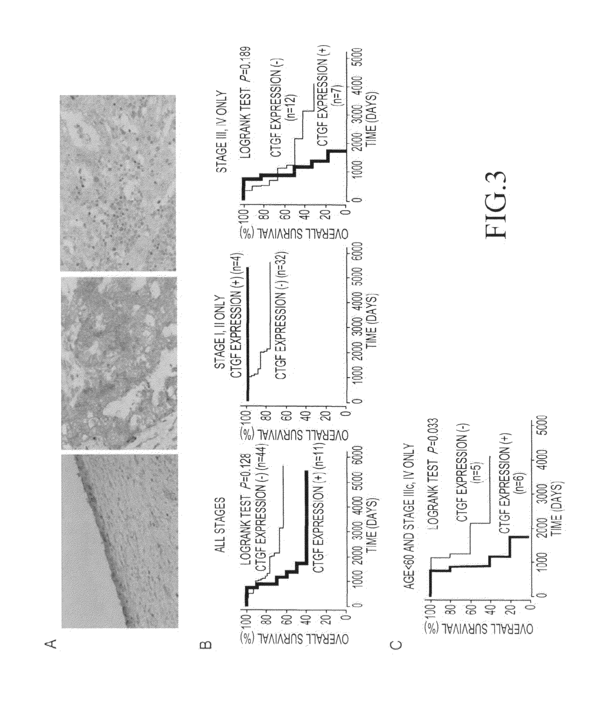 Method for detecting ovarian cancer and method for suppressing the same