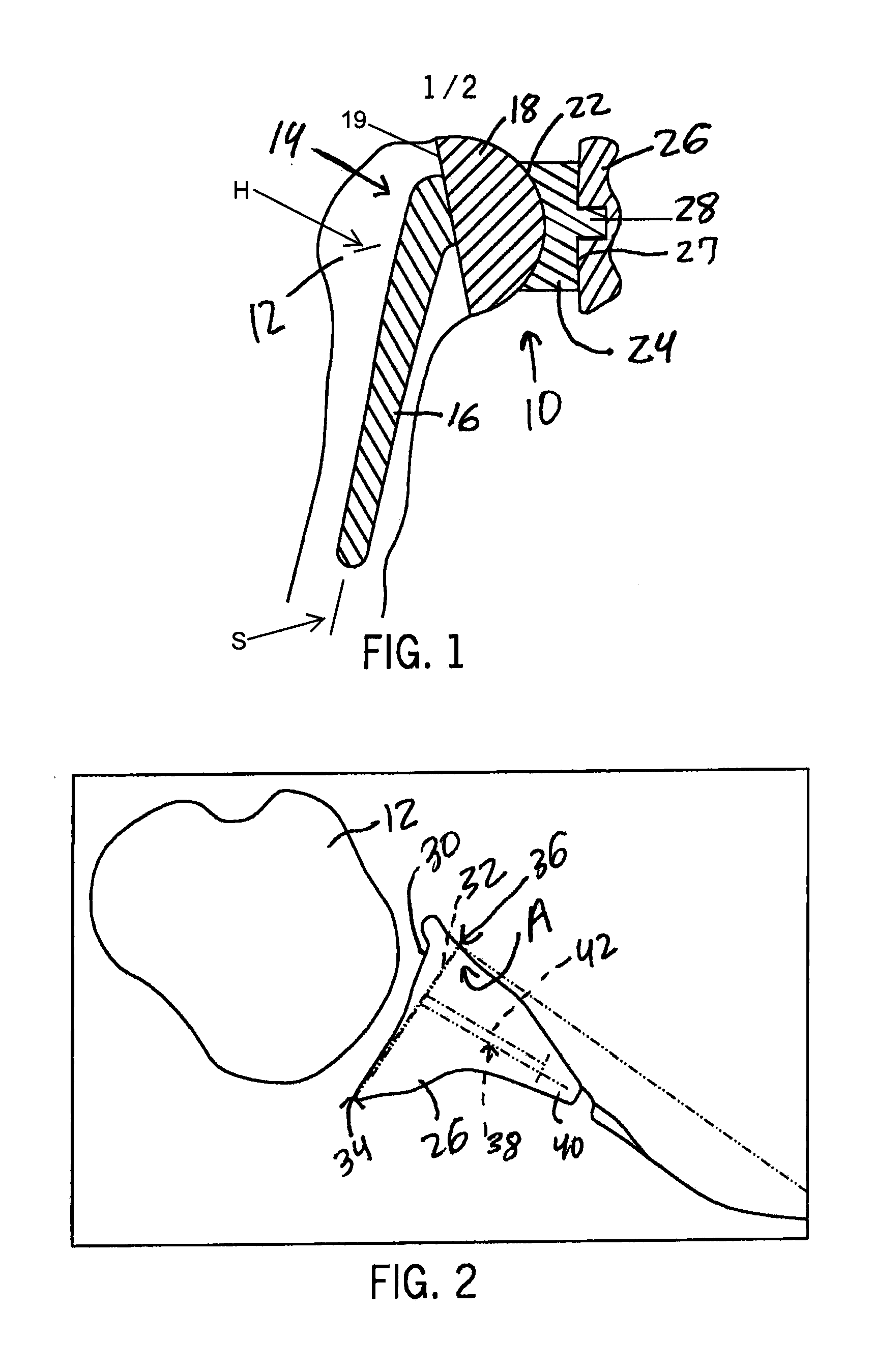 Method for optimization of joint arthroplasty component design