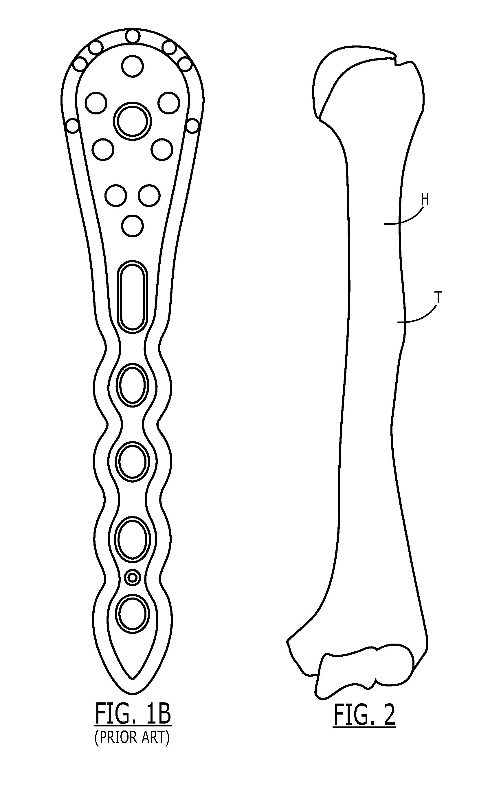 Proximal humeral fracture plate