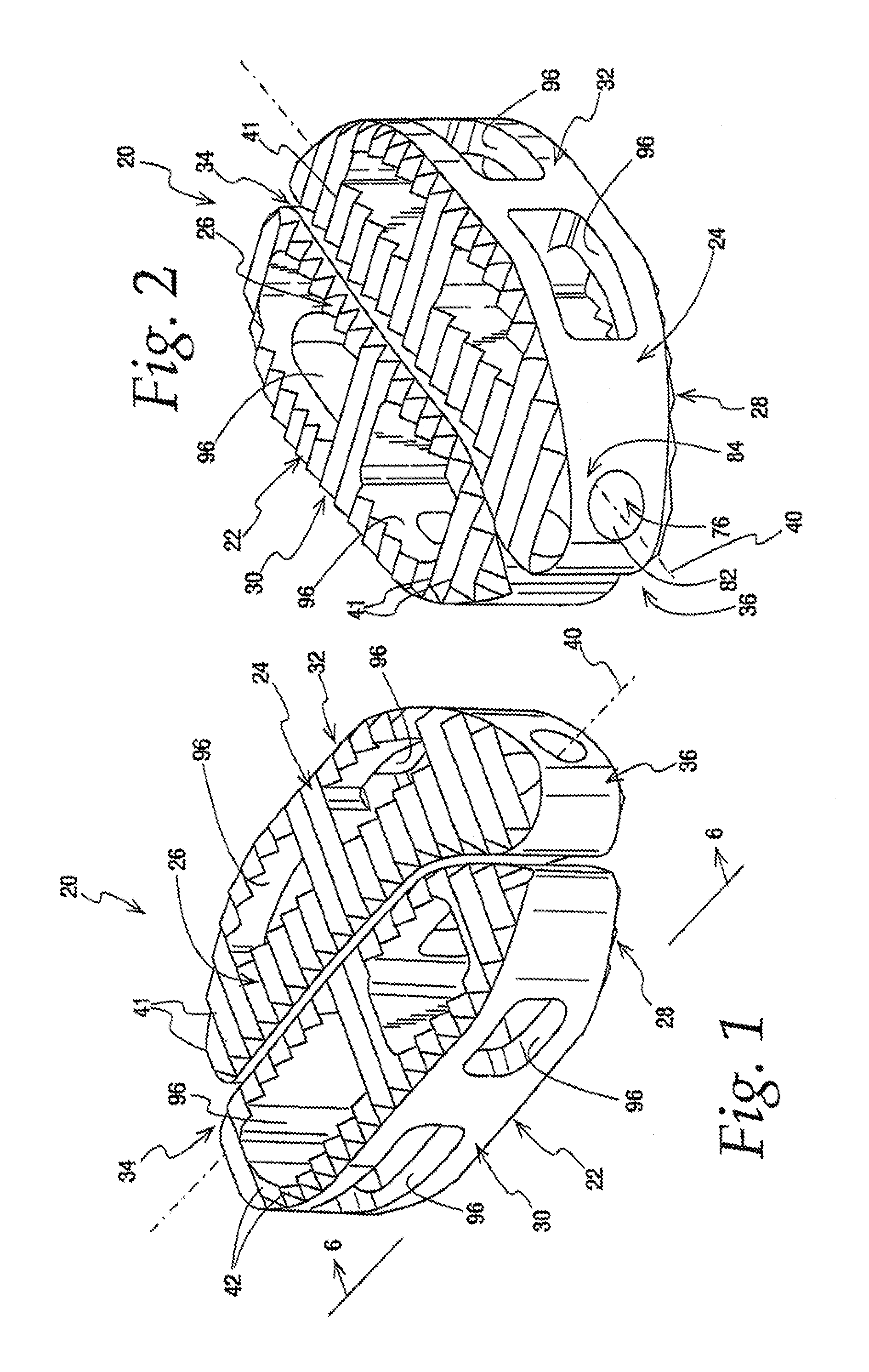 Interbody implant