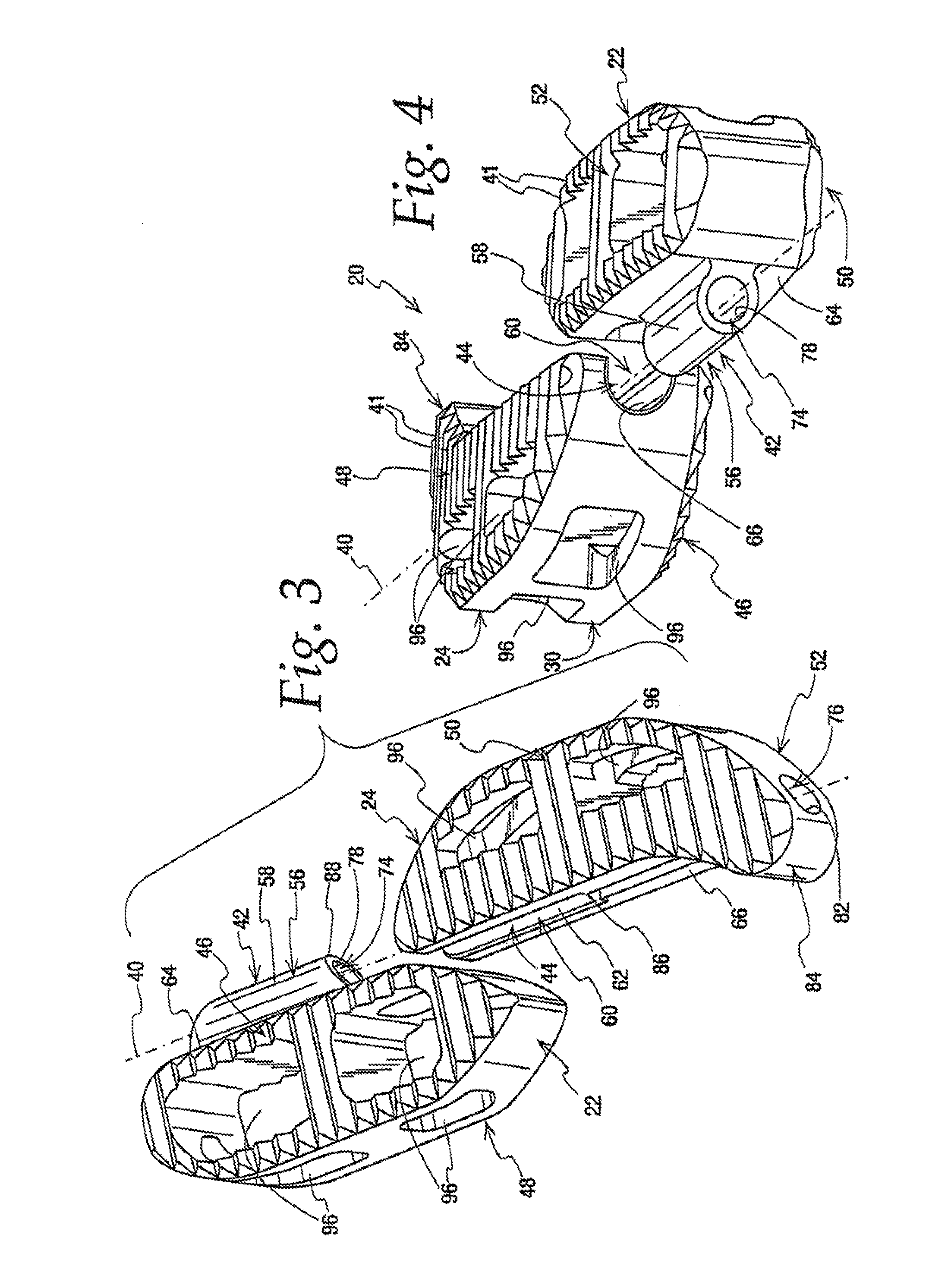 Interbody implant