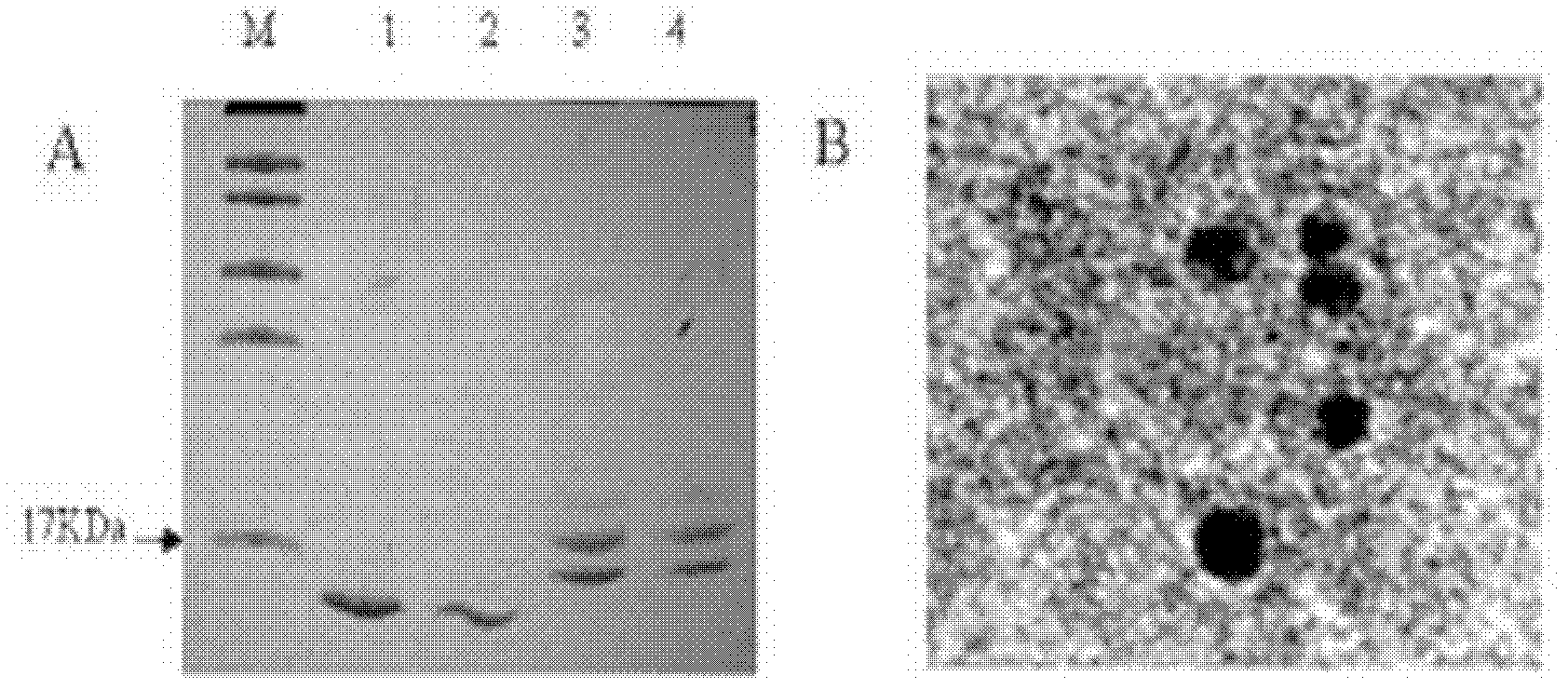 Angiotensin II receptor 1 type polypeptide-vector vaccine and application thereof