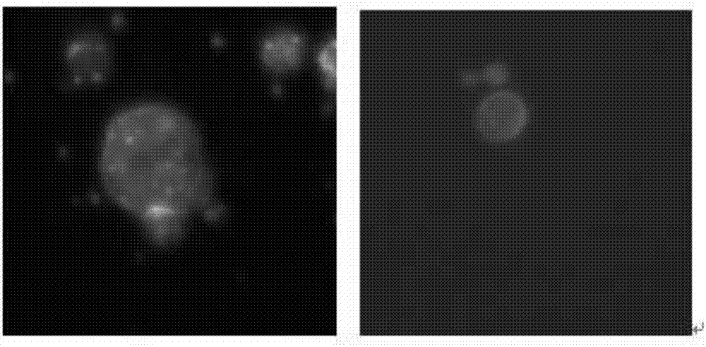 Preparation method of EpCAM (Epithelial Cell Adhesion Molecule) antibody immunomagnetic beads