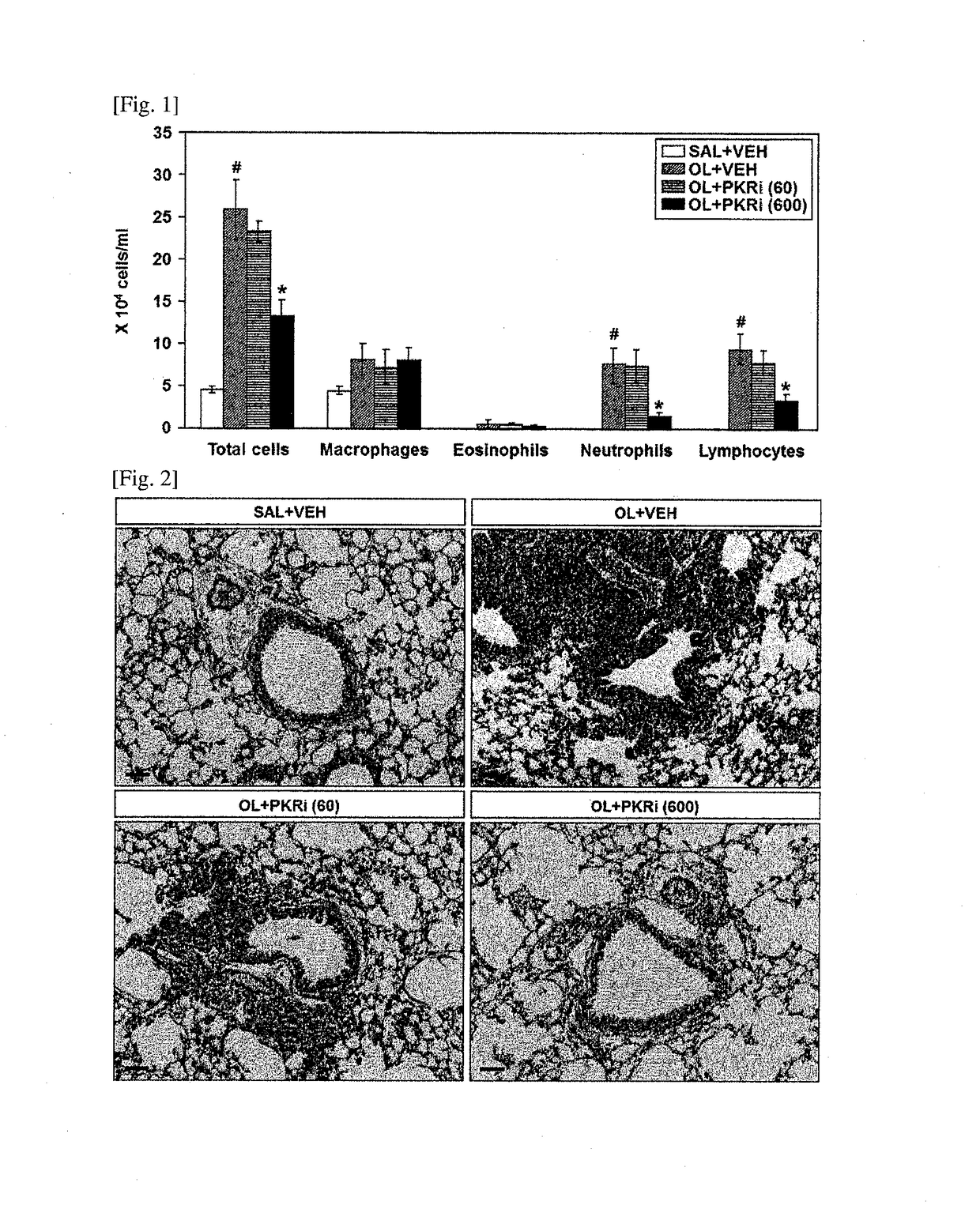 Composition for prevention or treatment of bronchial asthma comprising pkr inhibitor as active ingredient