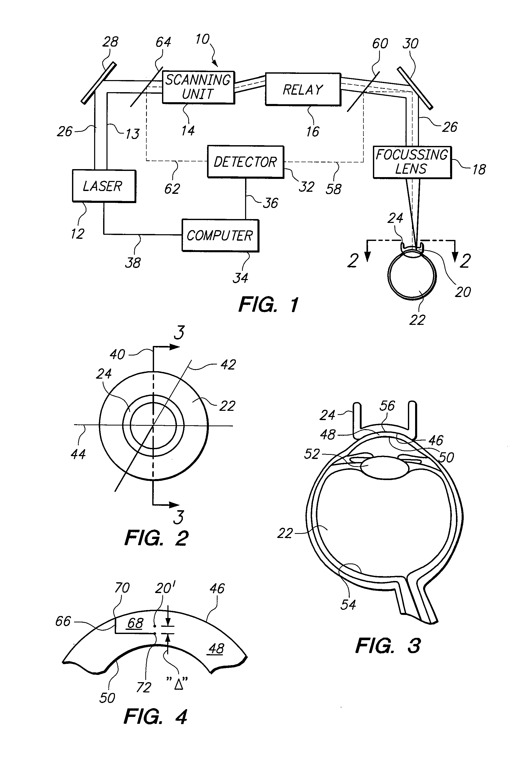 System and method for precise beam positioning in ocular surgery