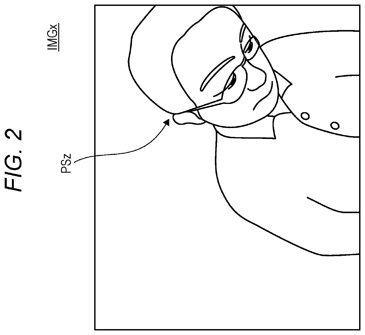 Capturing apparatus