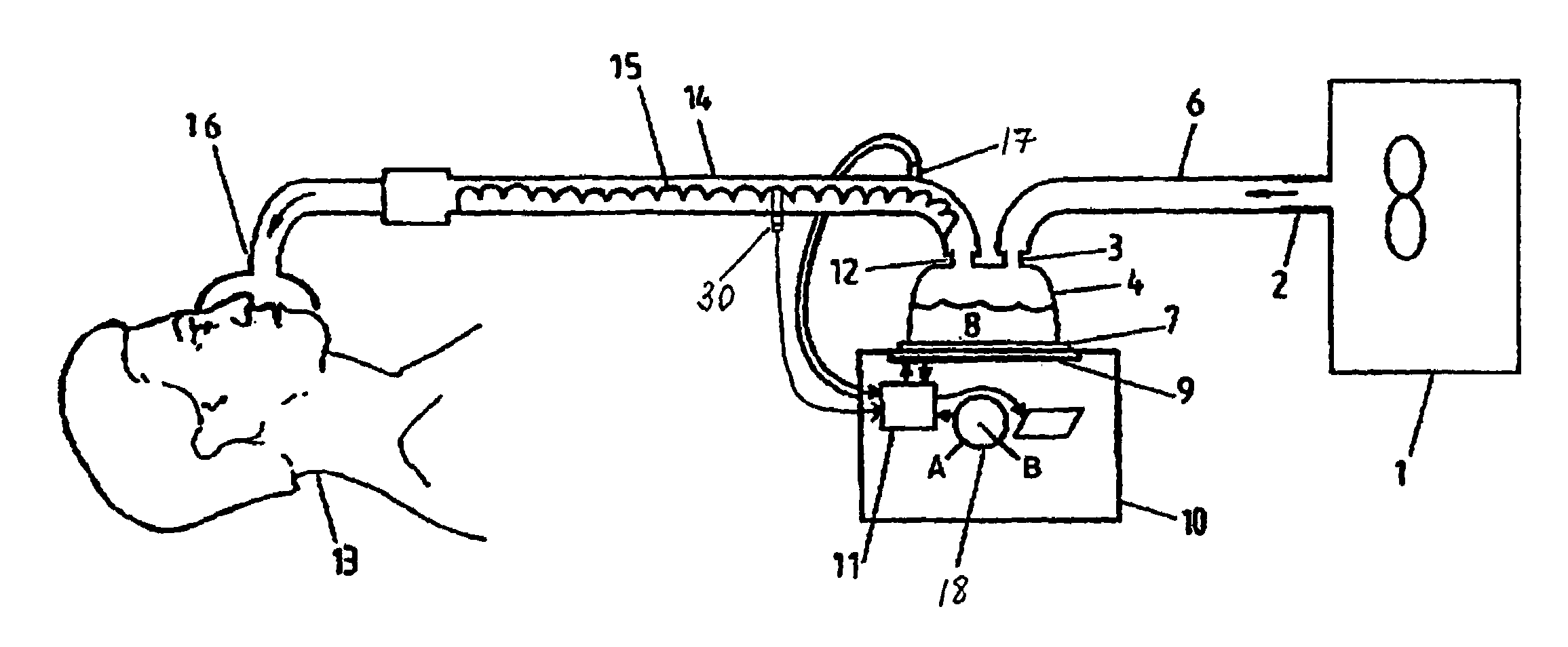 Conduit overheating detection system