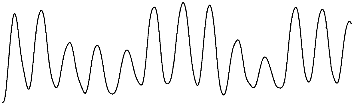 A method for analyzing cardiac shock signals to calculate short-term heart rate values