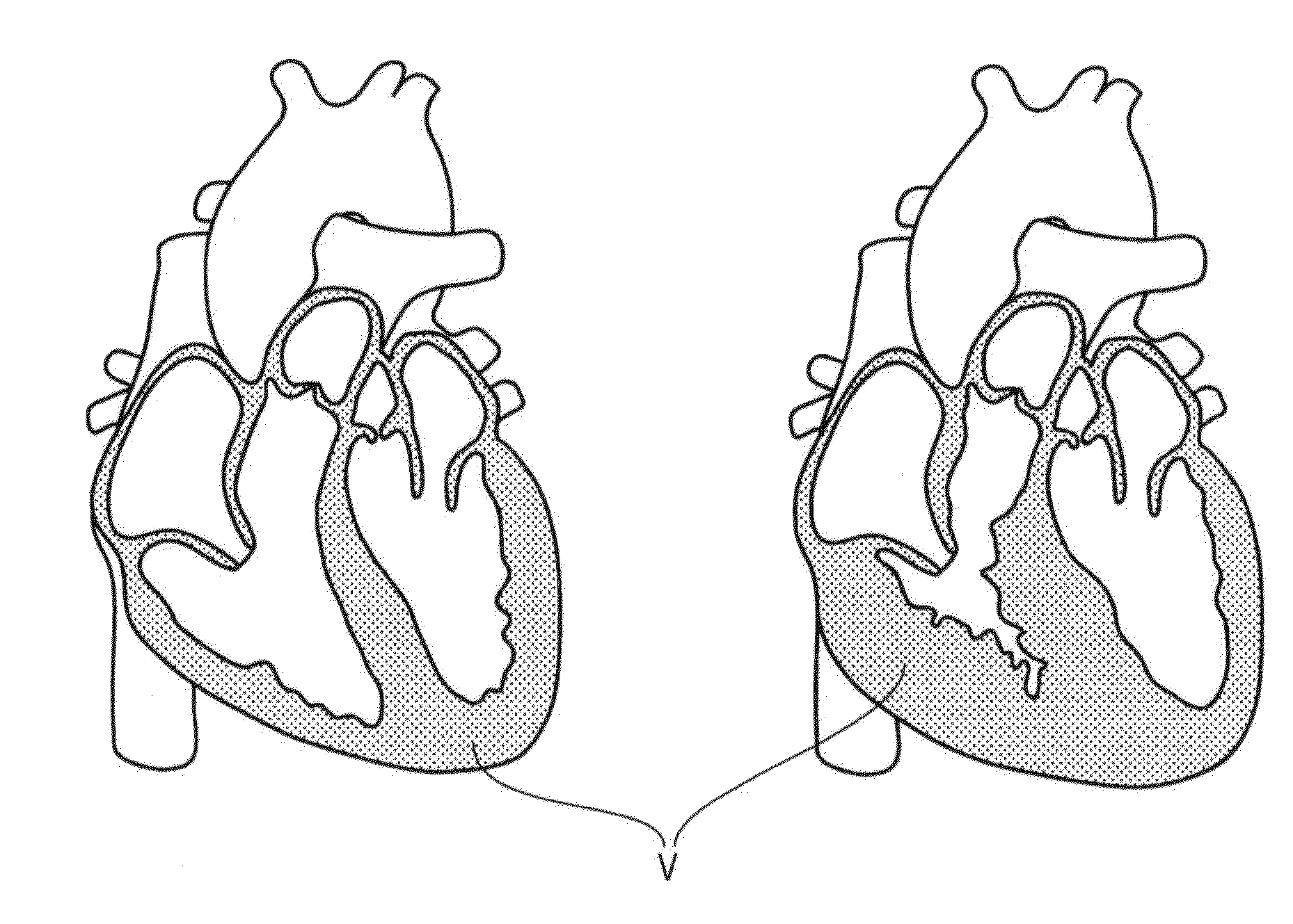 Volume rendering of medical images
