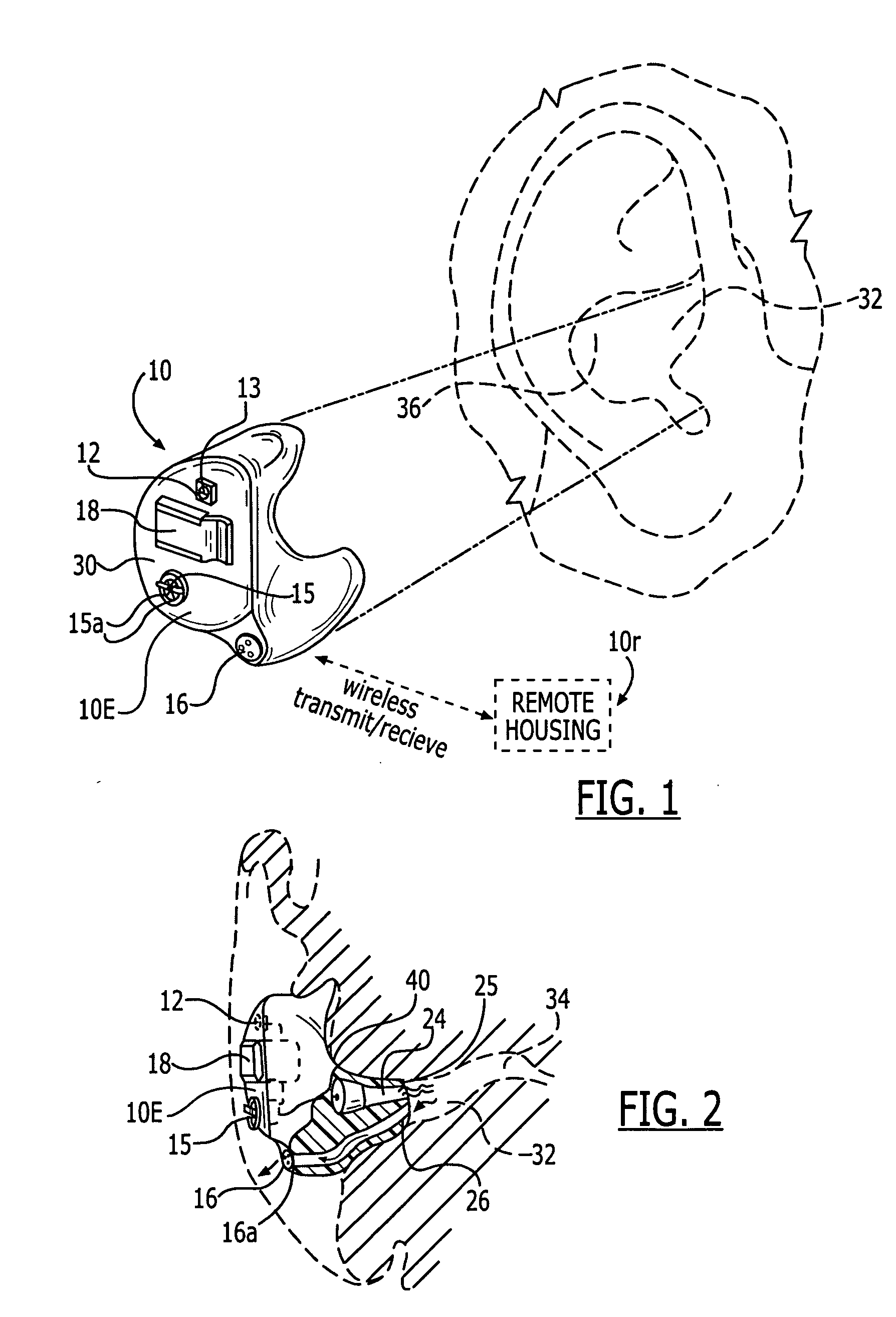 Methods and devices for treating non-stuttering speech-language disorders using delayed auditory feedback