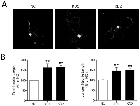 Application of m6a modification-related gene alkbh5 in promoting nerve axon repair