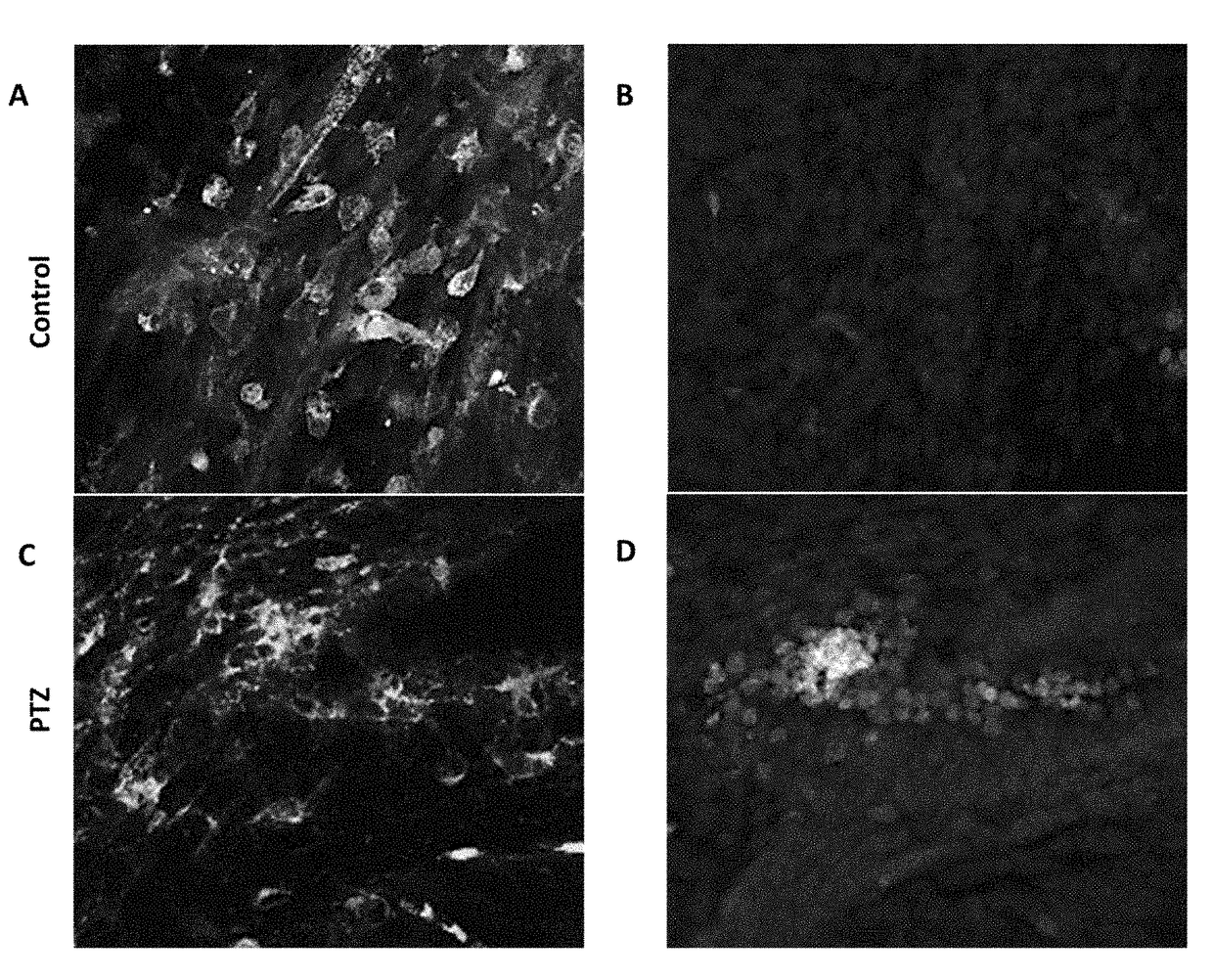 Selective connexin hemichannels blockers for the treatment of epilepsy