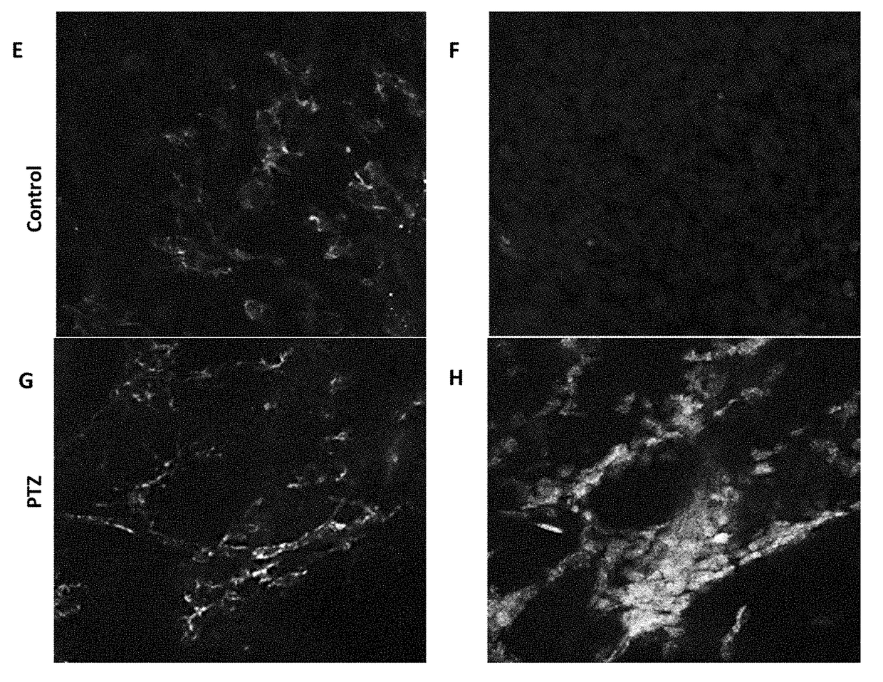 Selective connexin hemichannels blockers for the treatment of epilepsy