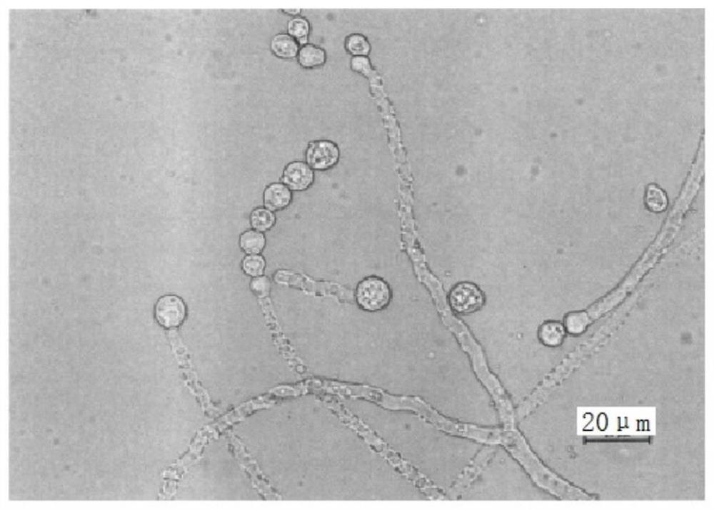 A composition for reducing visceral fat based on microencapsulated red yeast rice and its preparation method