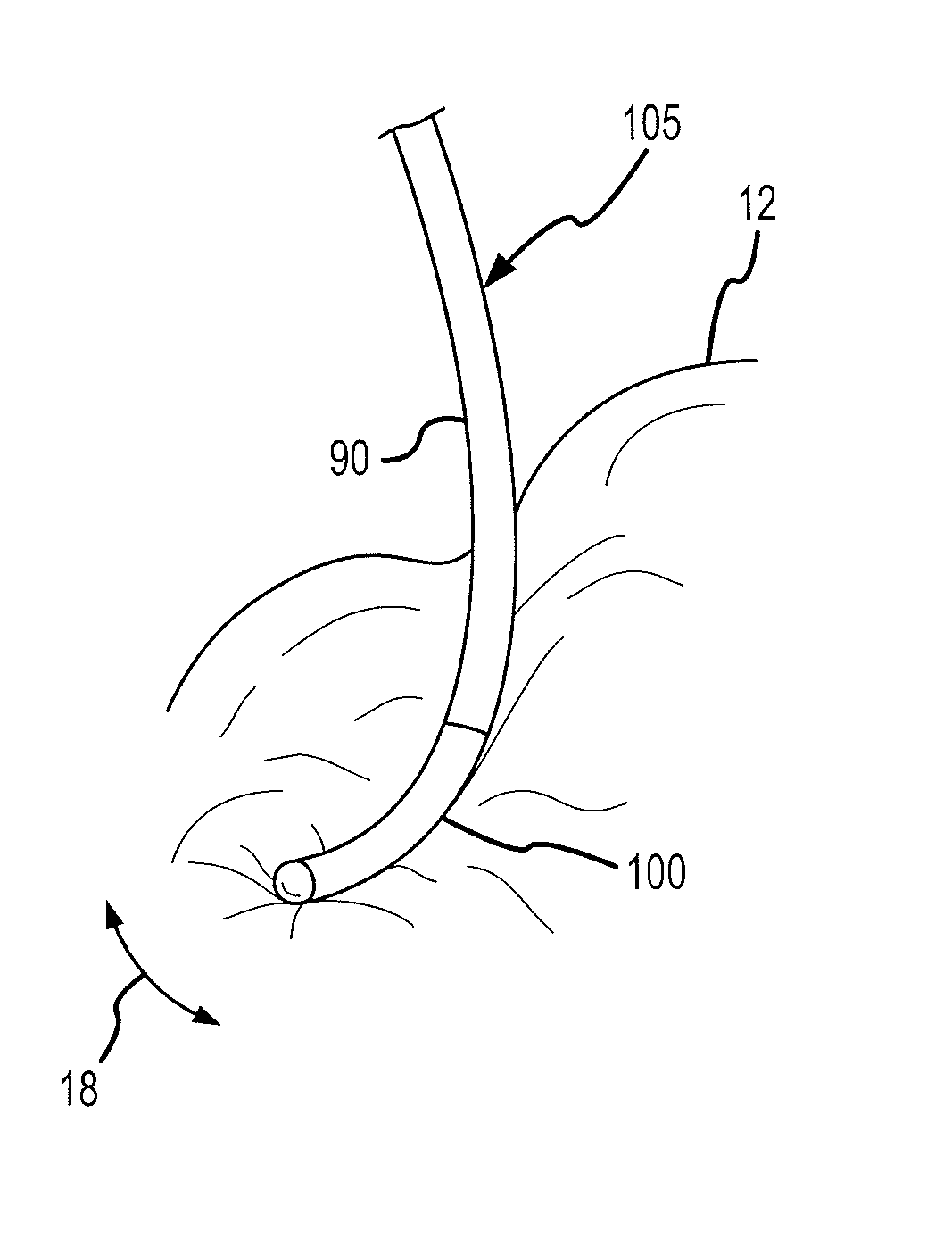 Ablation electrodes with capacitive sensors for resolving magnitude and direction of forces imparted to a distal portion of a cardiac catheter