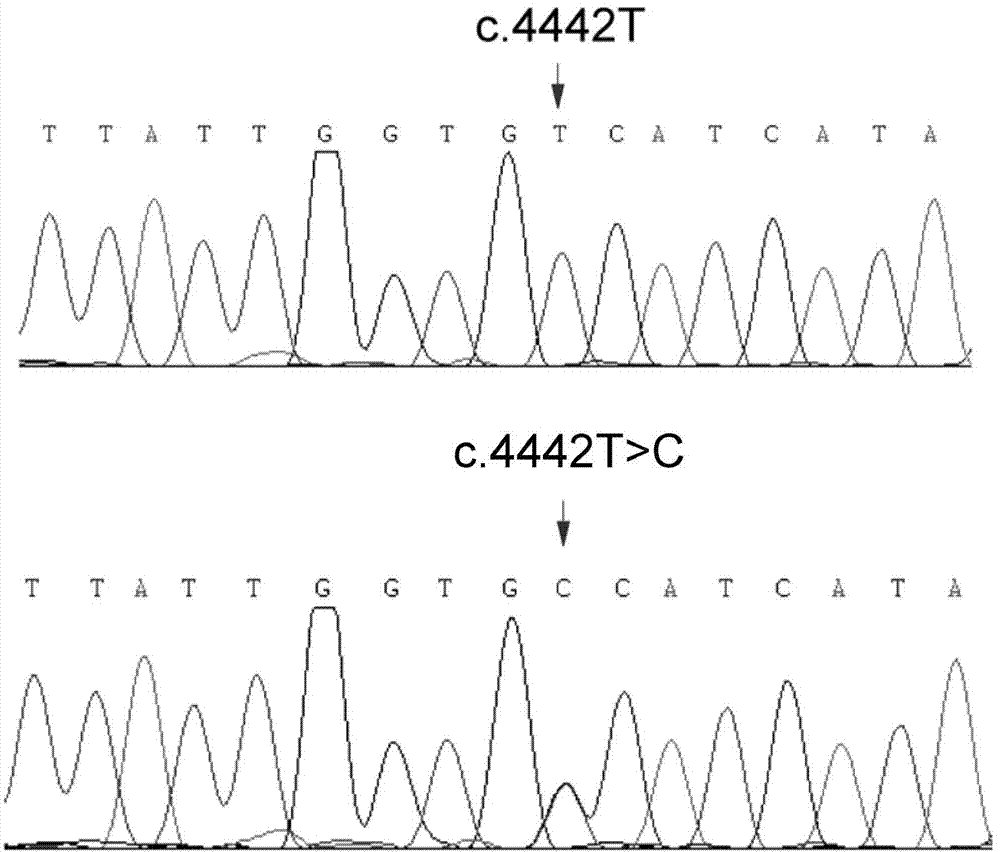 Genetical epilepsy-combining febrile convulsion additional symptom SCN1A gene new mutation