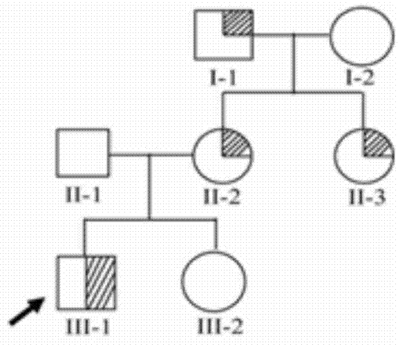 Genetical epilepsy-combining febrile convulsion additional symptom SCN1A gene new mutation