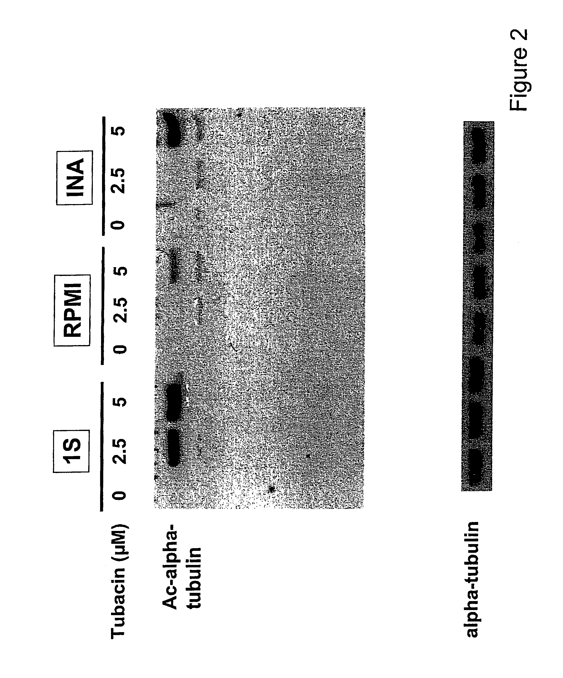 Treatment of protein degradation disorders