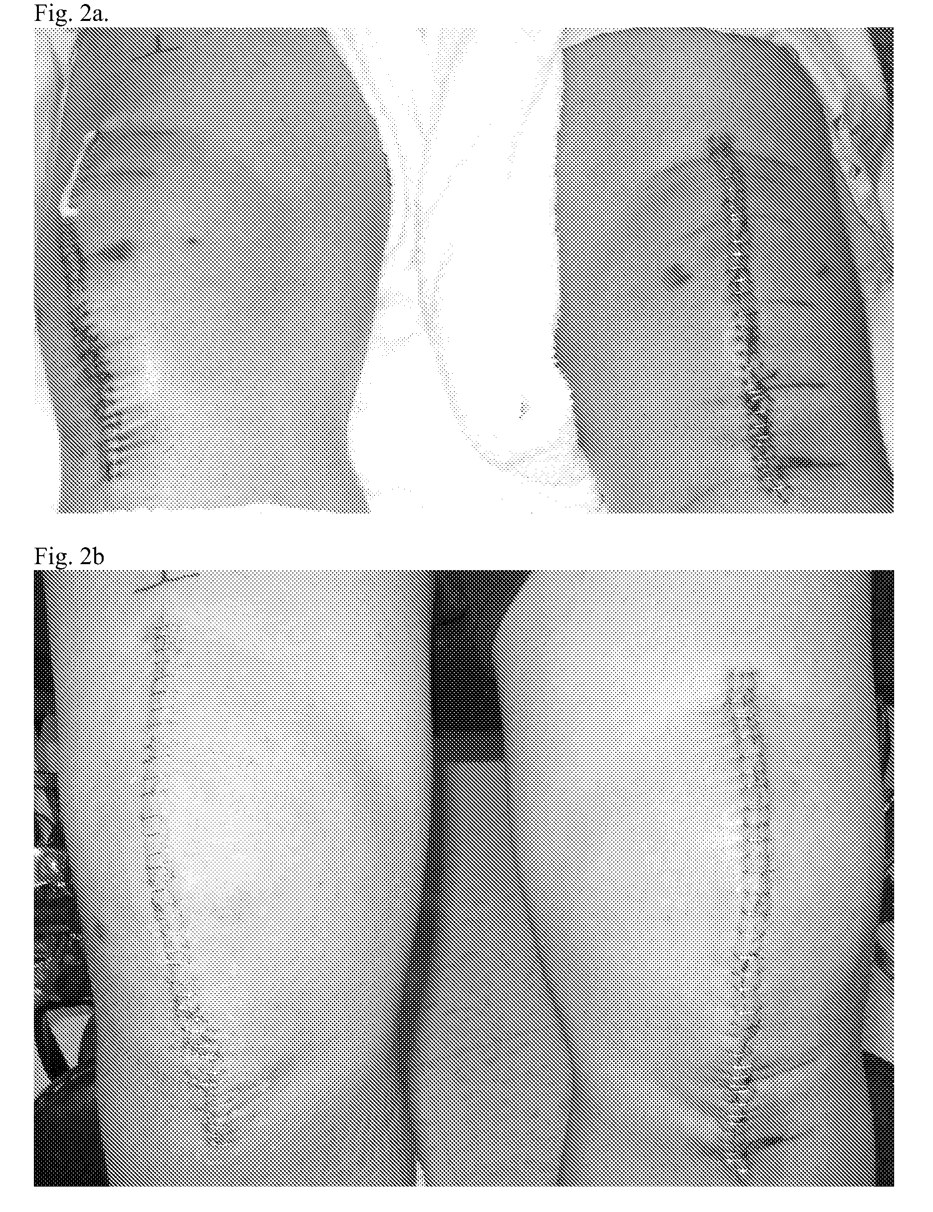 Methods and compositions for wound healing