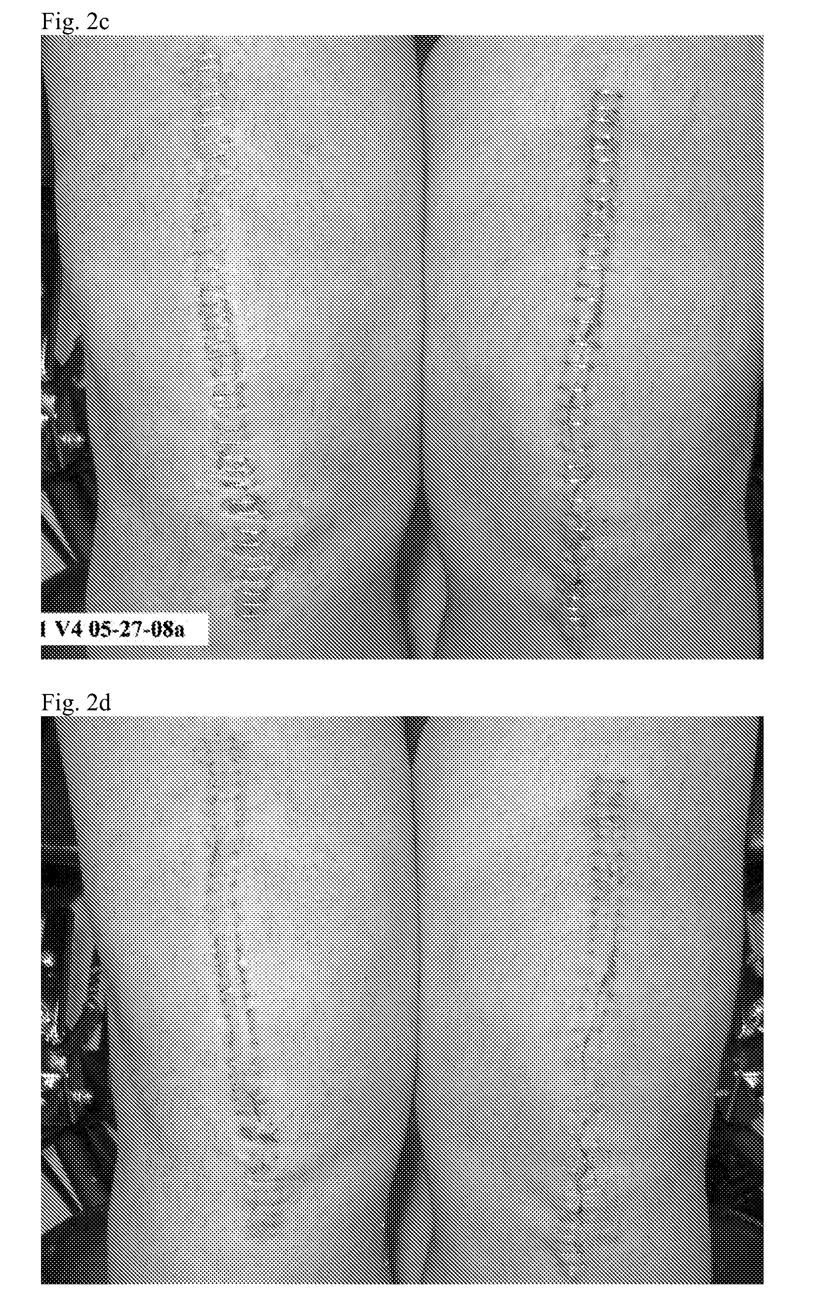 Methods and compositions for wound healing