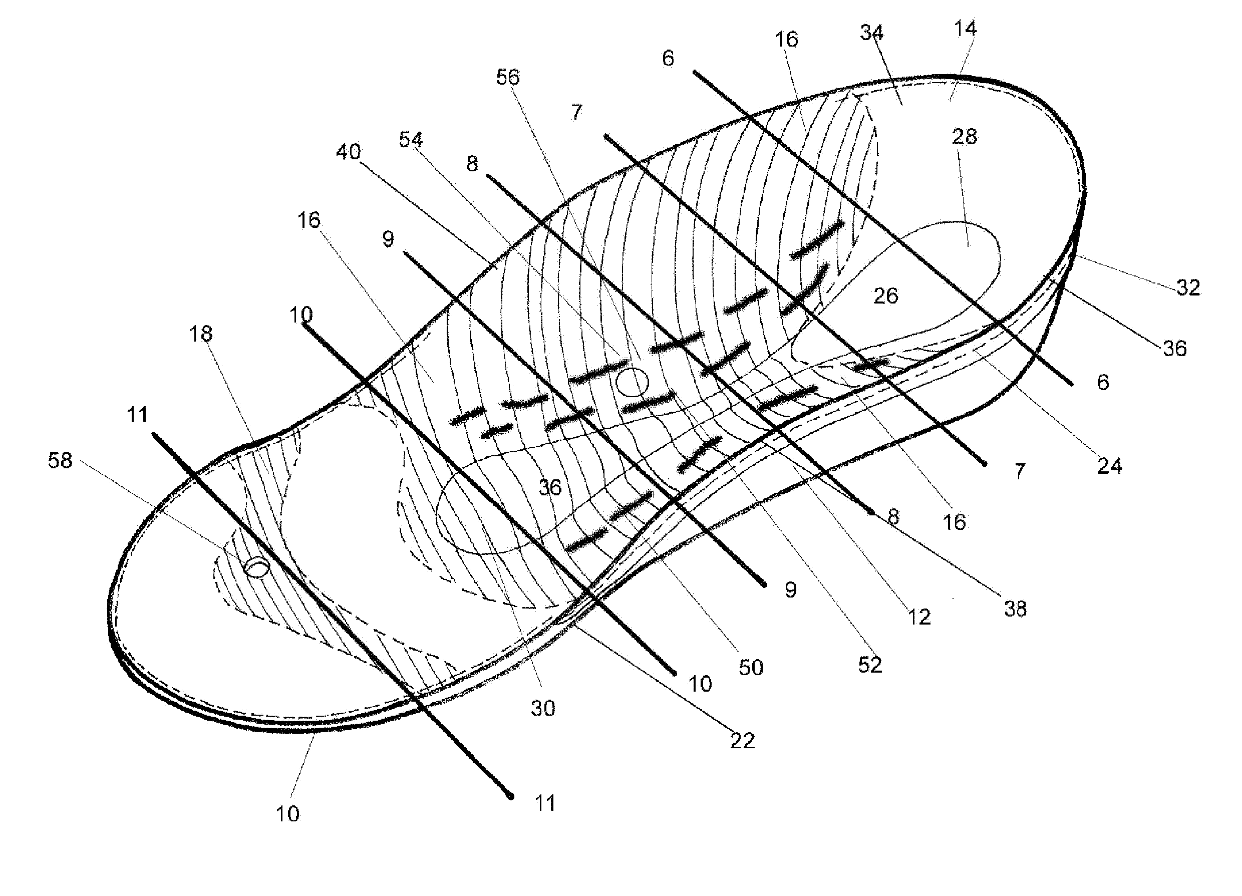 Orthotic device