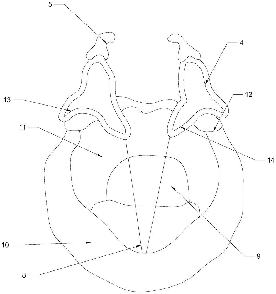 Demonstration model of cricothyroid muscle action