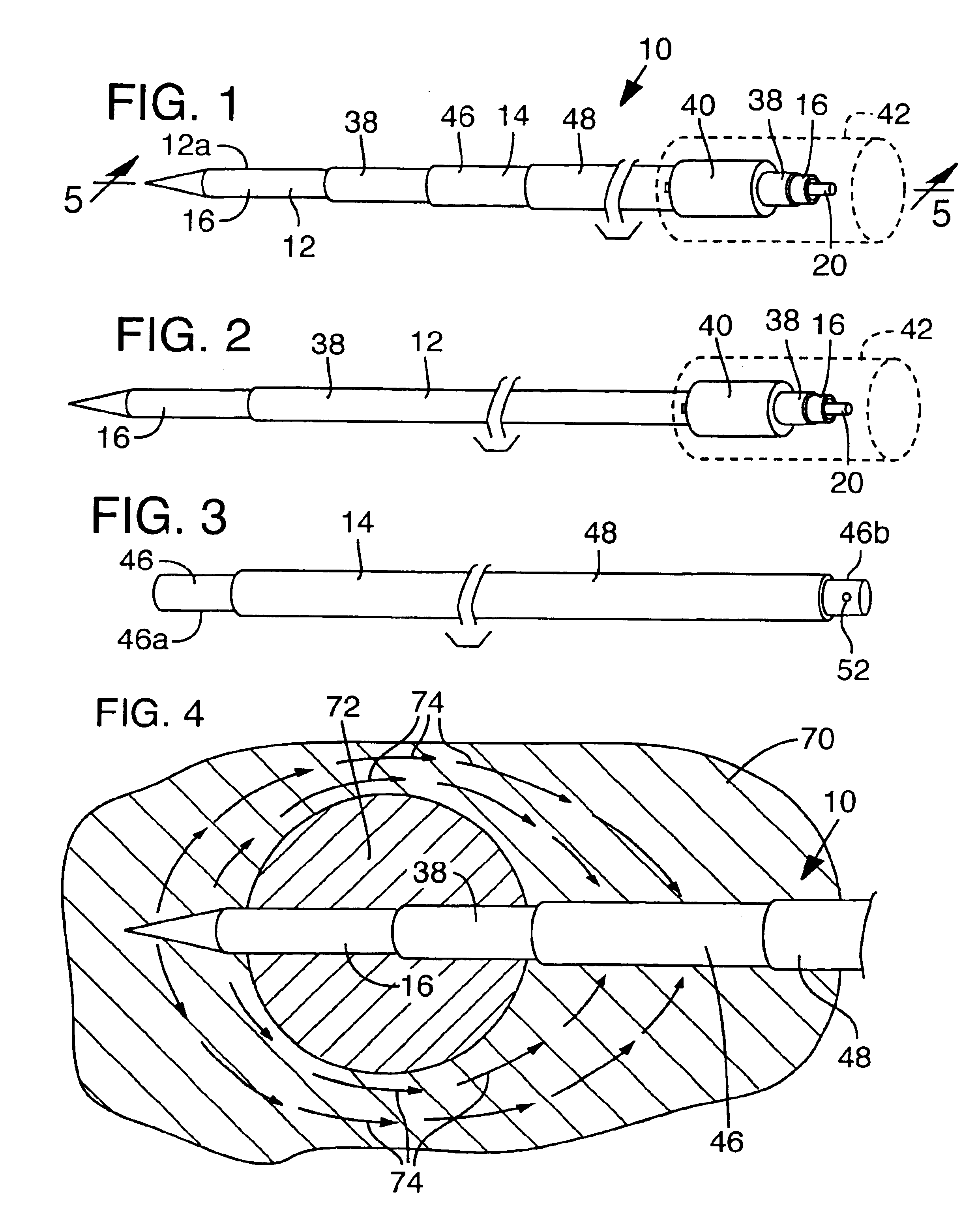 Cryo-surgical apparatus and method of use
