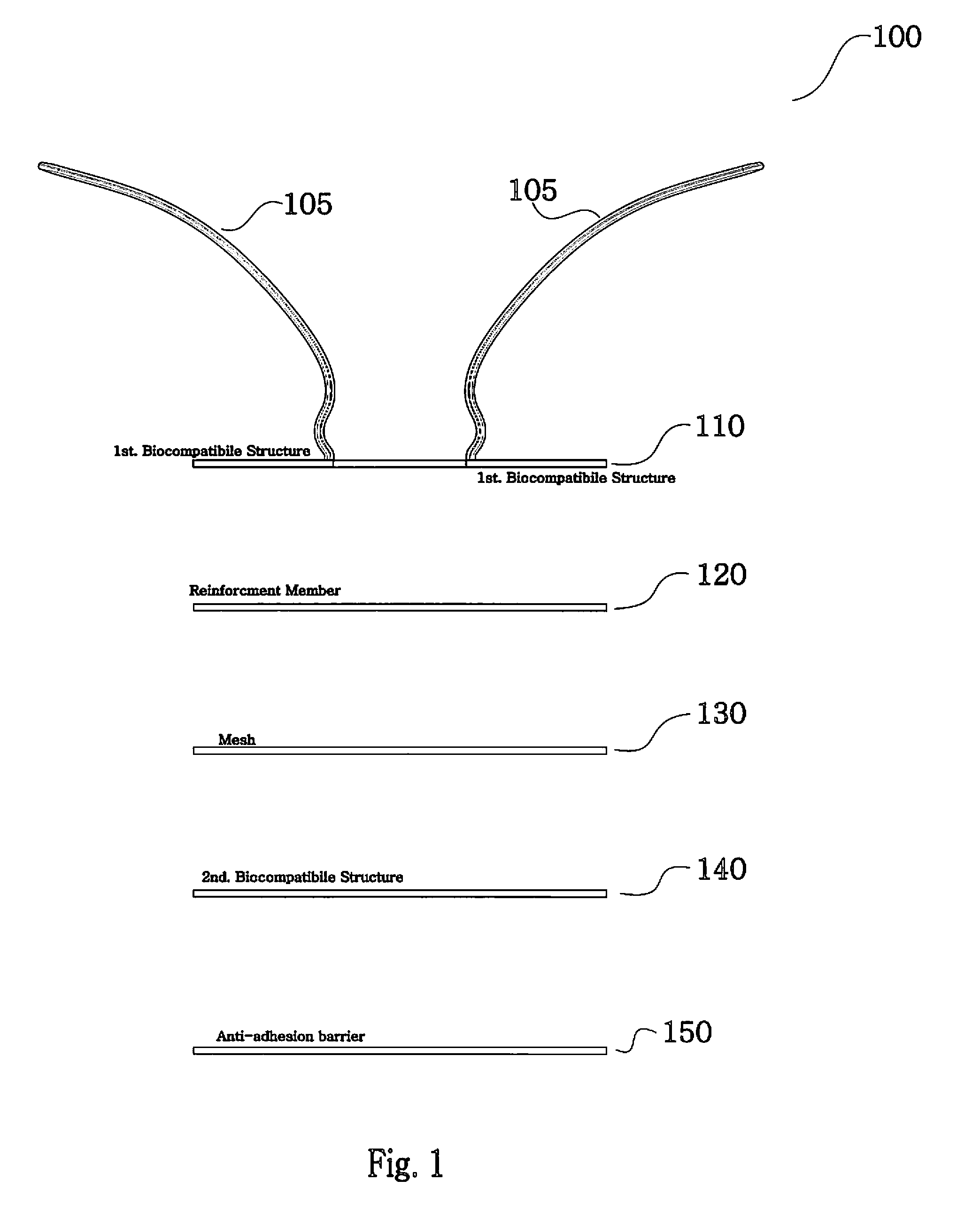 Implantable prosthesis for repairing or reinforcing an anatomical defect