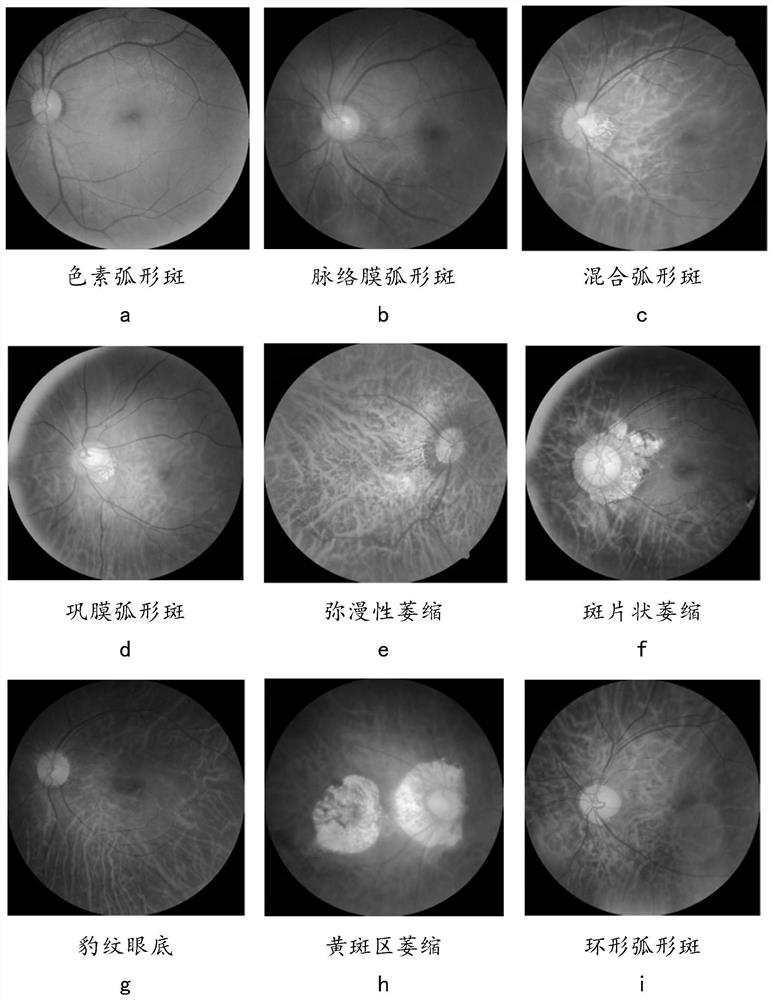 Eye fundus image analysis system and method and electronic equipment