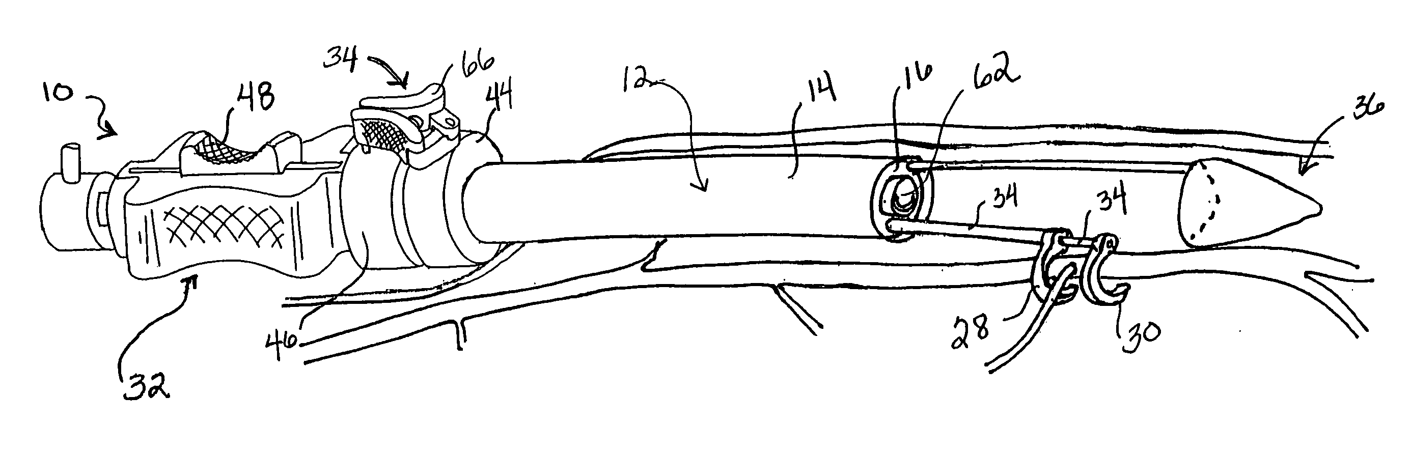 Method and apparatus for endoscopic dissection of blood vessels