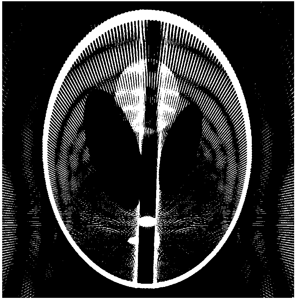 Computerized Tomography (CT) image uniformization metal artifact correction method based on four-order total-variation shunting