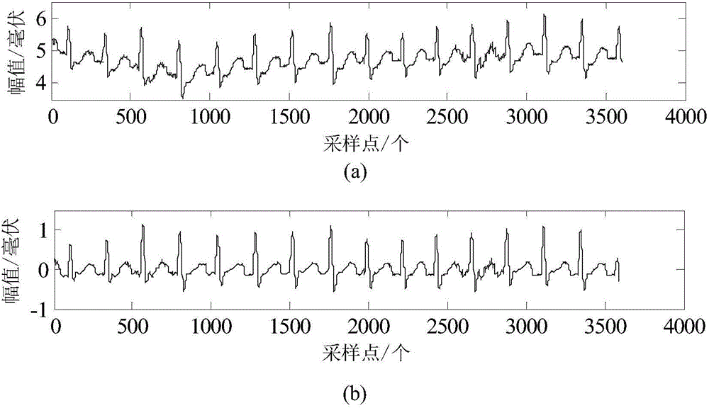 Electrocardiogram classifying method based on fuzzy inference and weighted similarity measurement