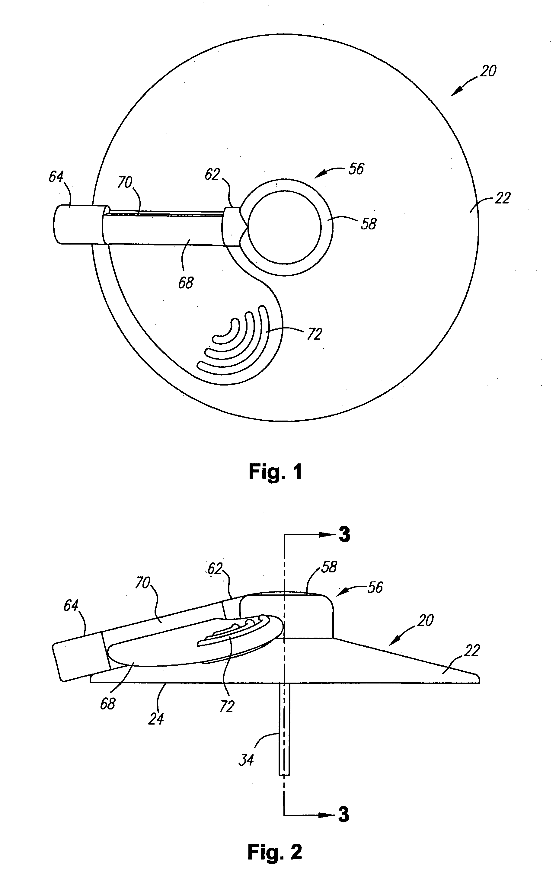 Apparatus and method for delivery of therapeutic and/or diagnostic agents