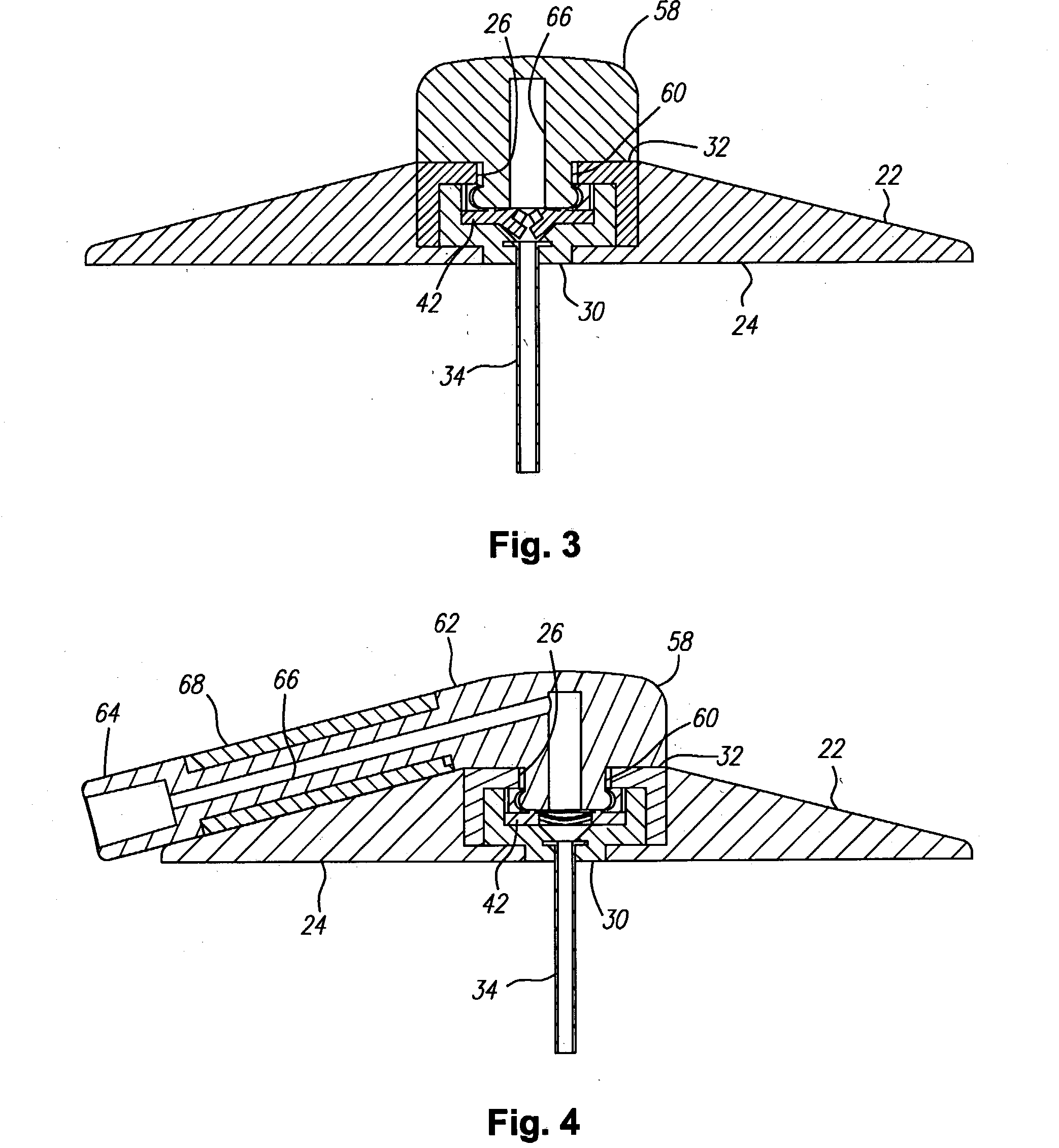 Apparatus and method for delivery of therapeutic and/or diagnostic agents