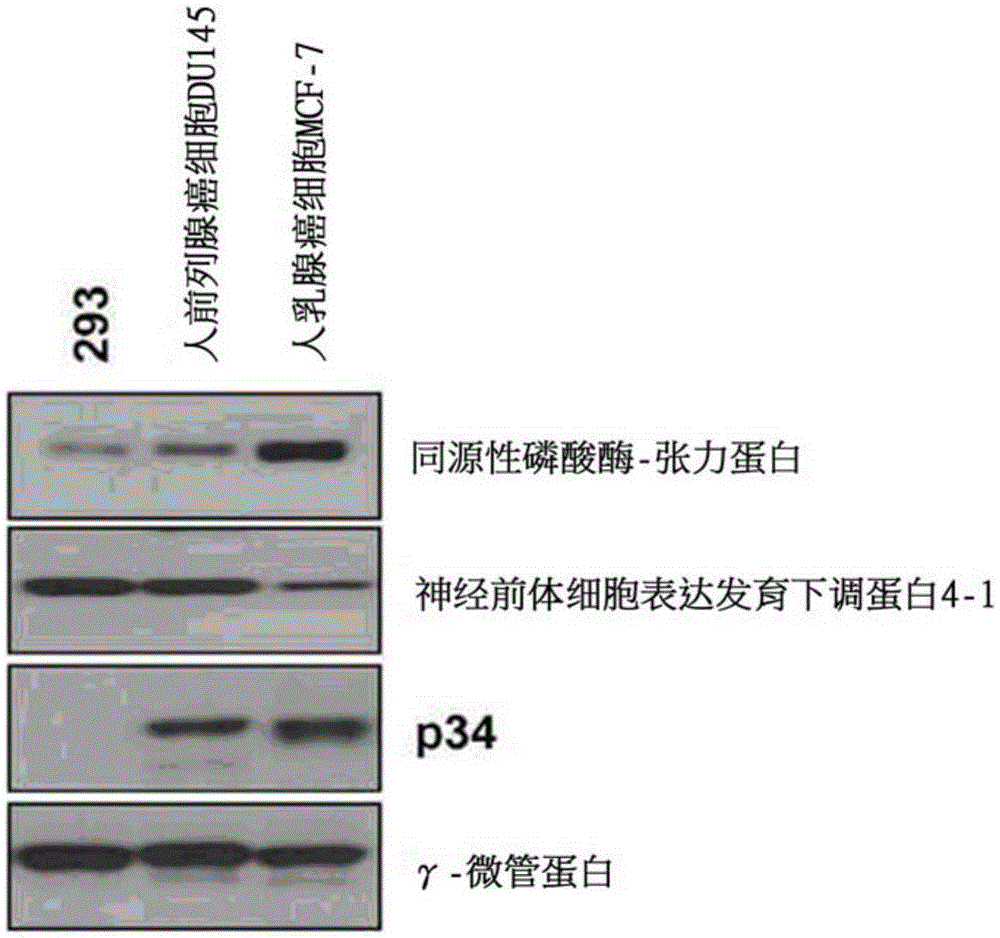 Composition for treatment or metastasis suppression of cancers which includes P34 expression inhibitor or activity inhibitor as active ingredient
