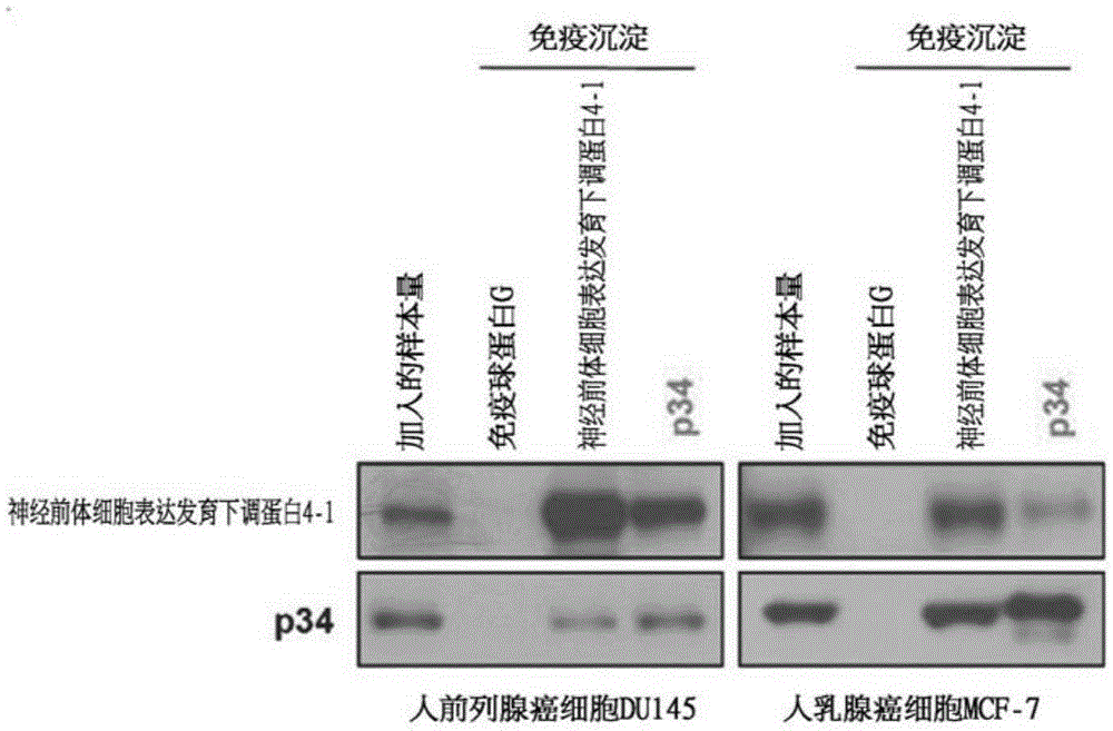 Composition for treatment or metastasis suppression of cancers which includes P34 expression inhibitor or activity inhibitor as active ingredient